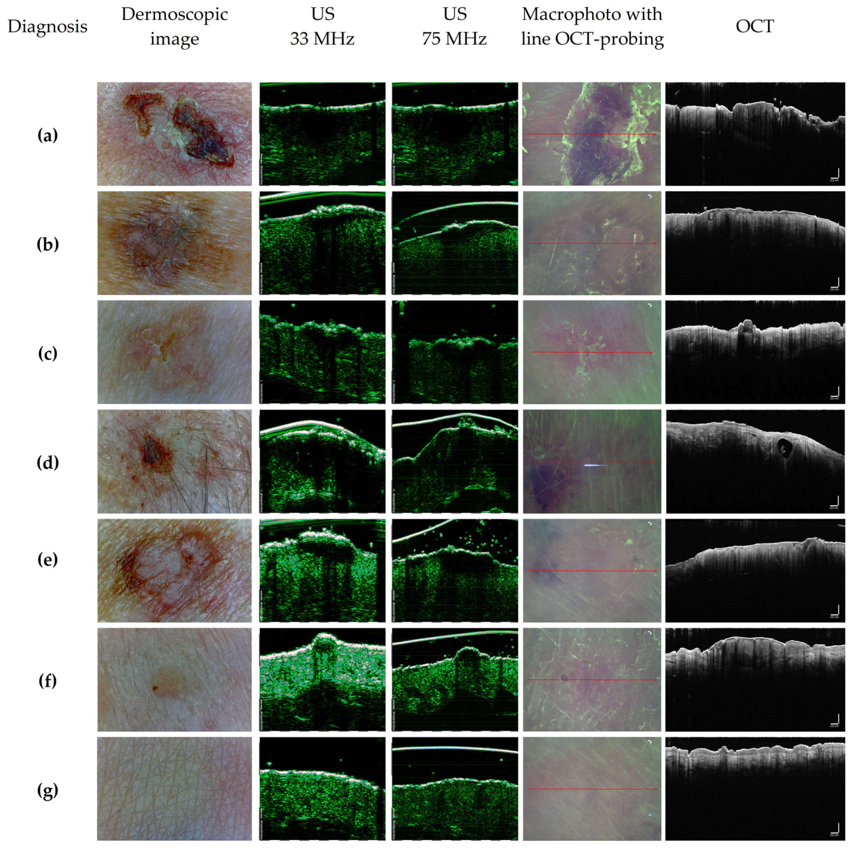 Diagnostics 14 00202 g005