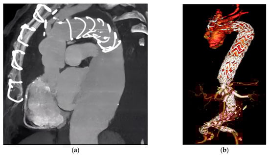 Diagnostics 14 00205 g001