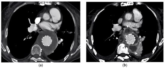 Diagnostics 14 00205 g002