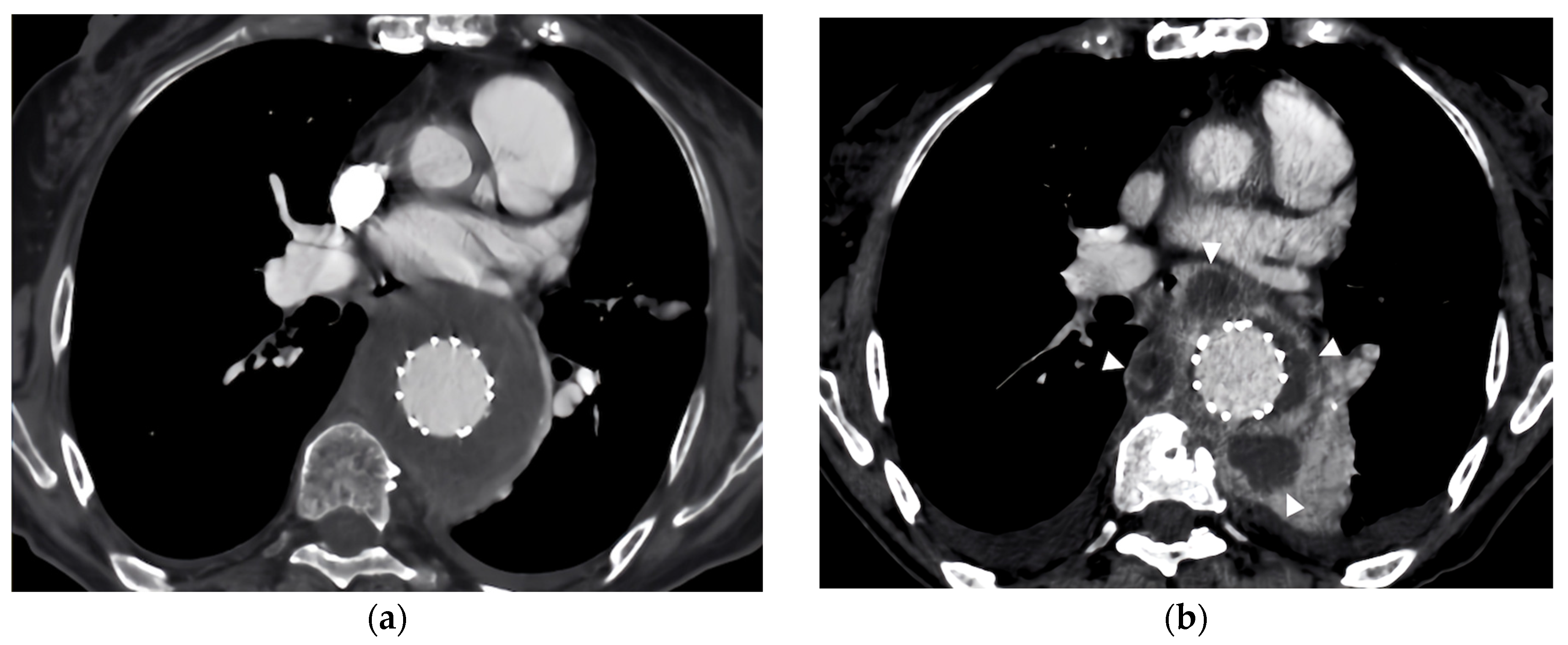 Diagnostics 14 00205 g002