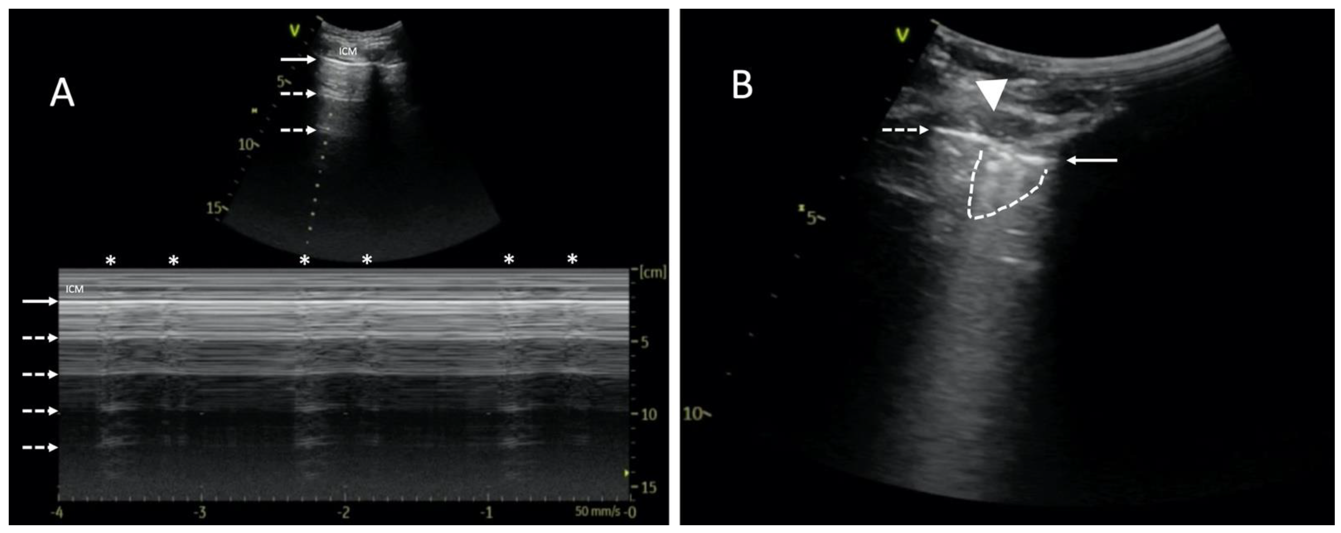 Diagnostics 14 00206 g001