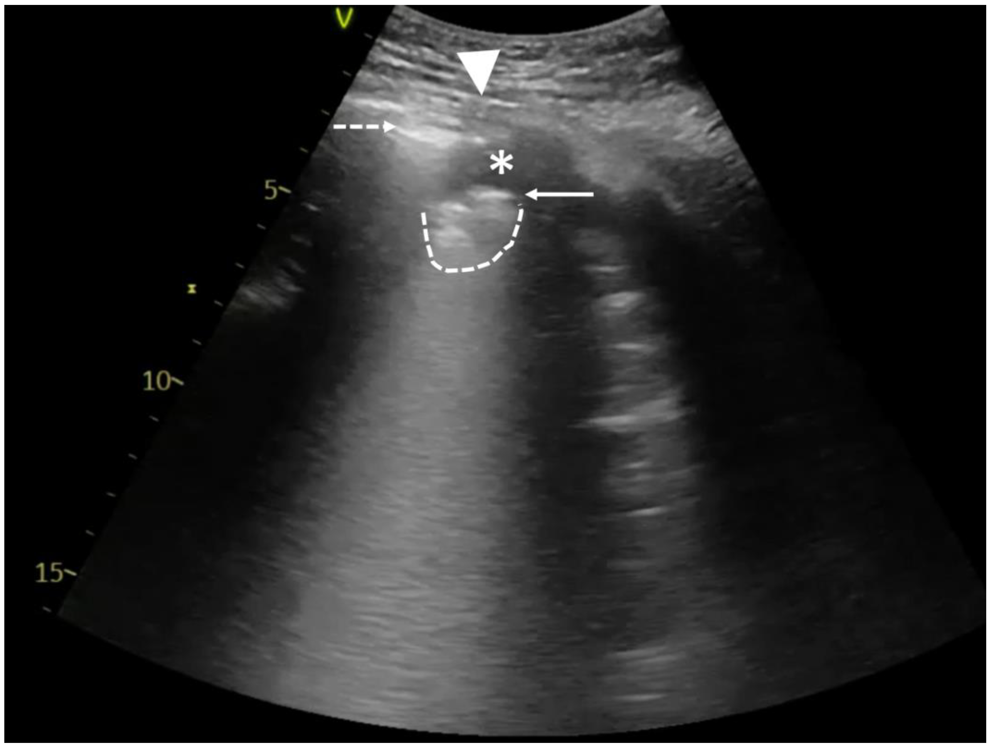Diagnostics 14 00206 g002