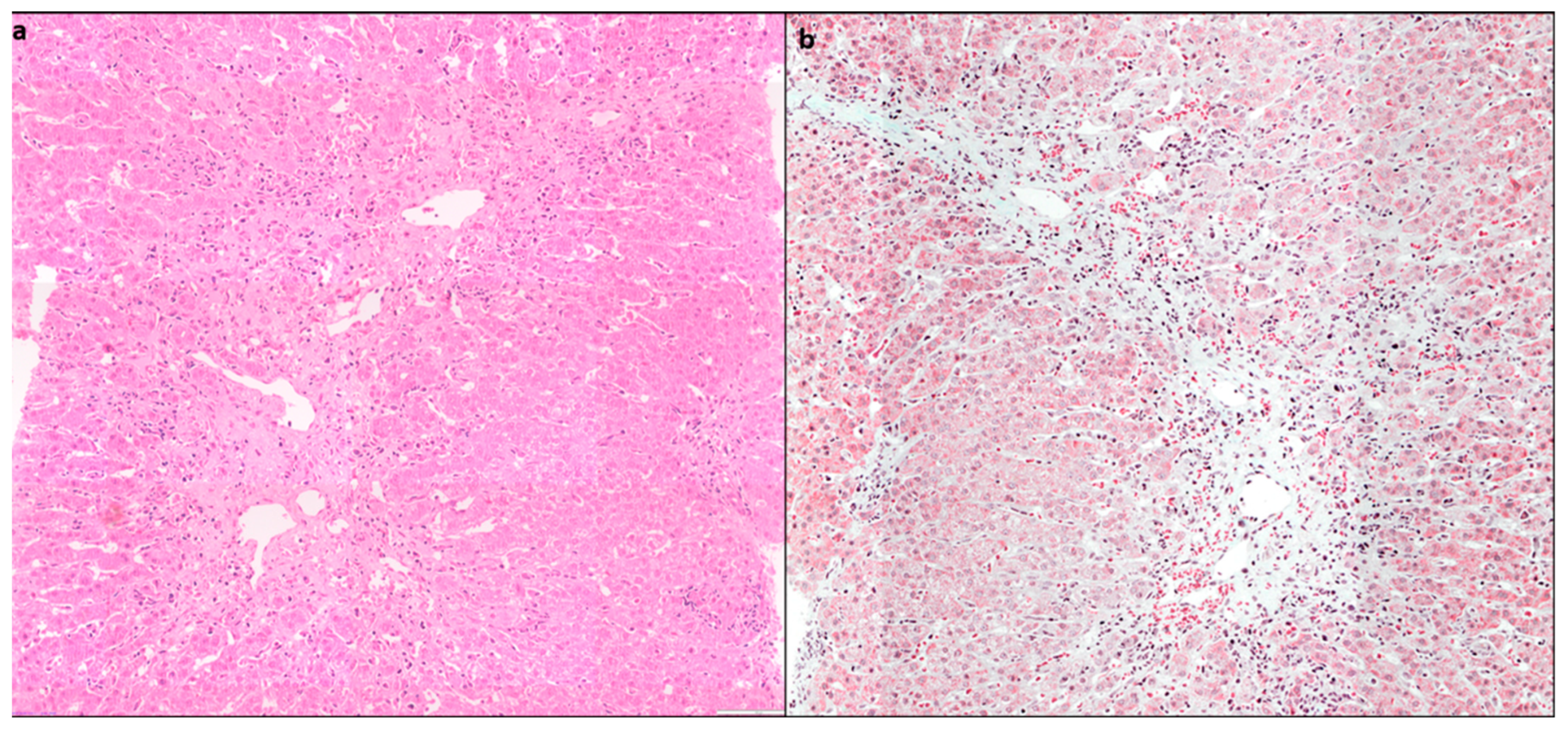 Diagnostics 14 00210 g003 Diagnostics 14 00210 g003