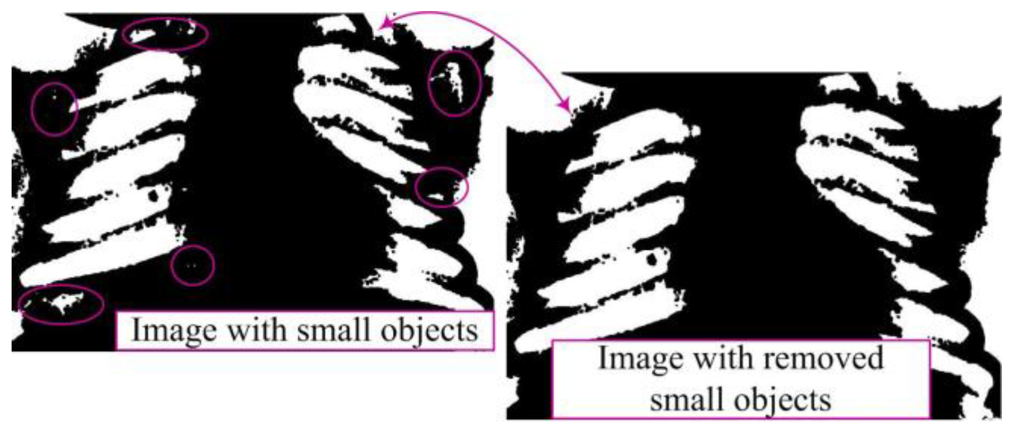 Diagnostics 14 00214 g005