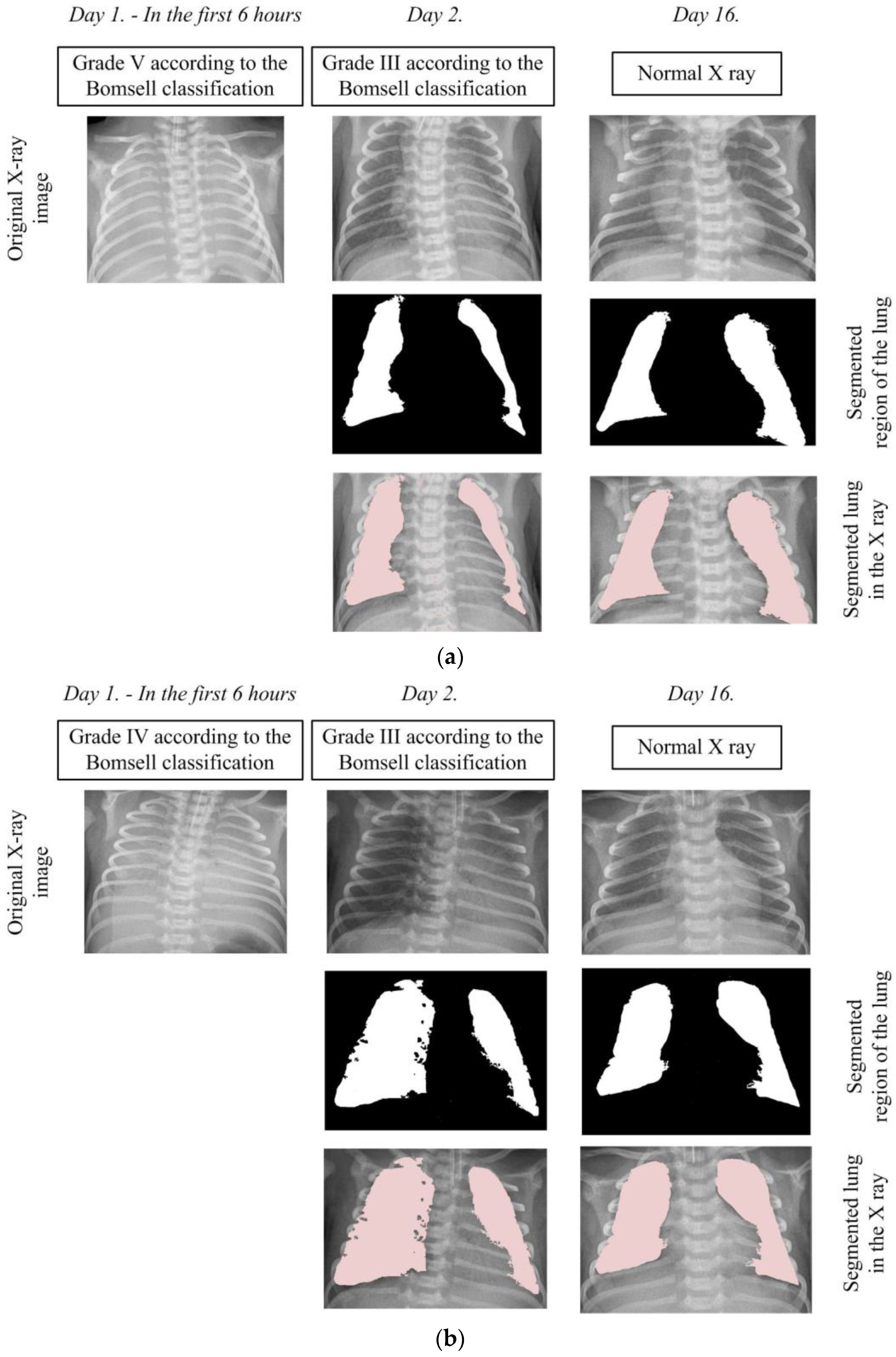 Diagnostics 14 00214 g007