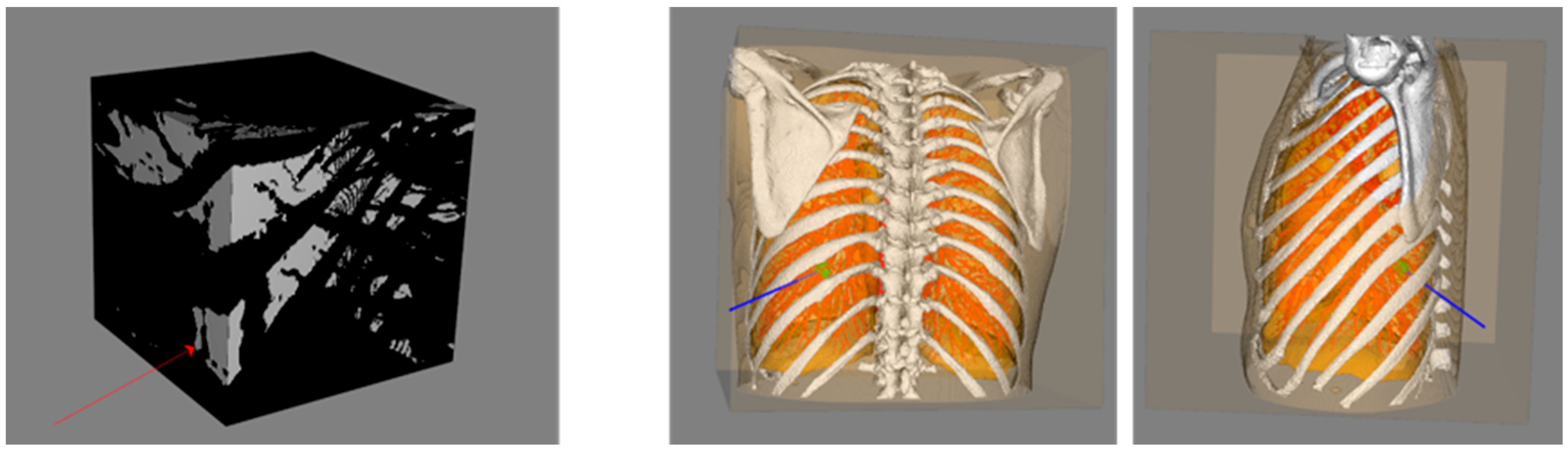 Diagnostics 14 00215 g006