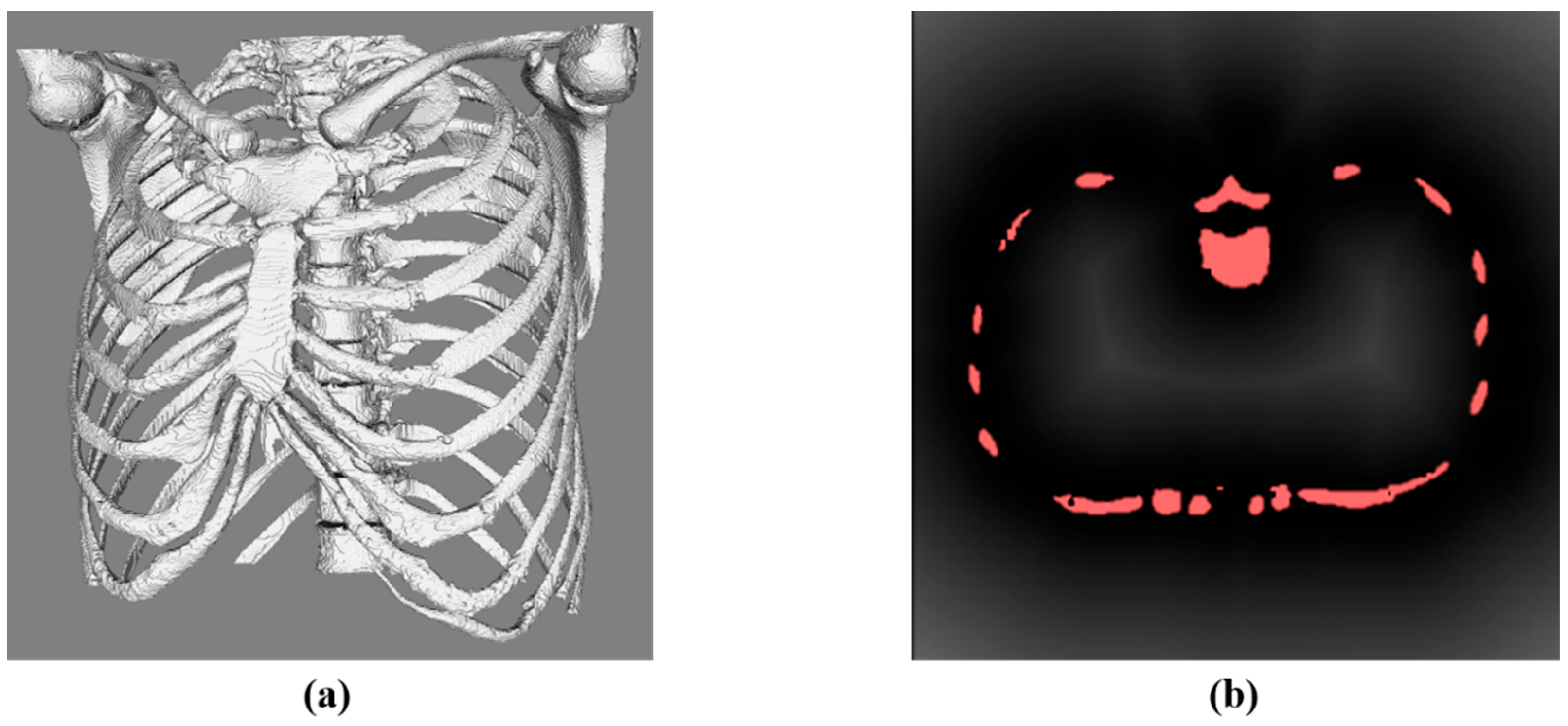Diagnostics 14 00215 g007