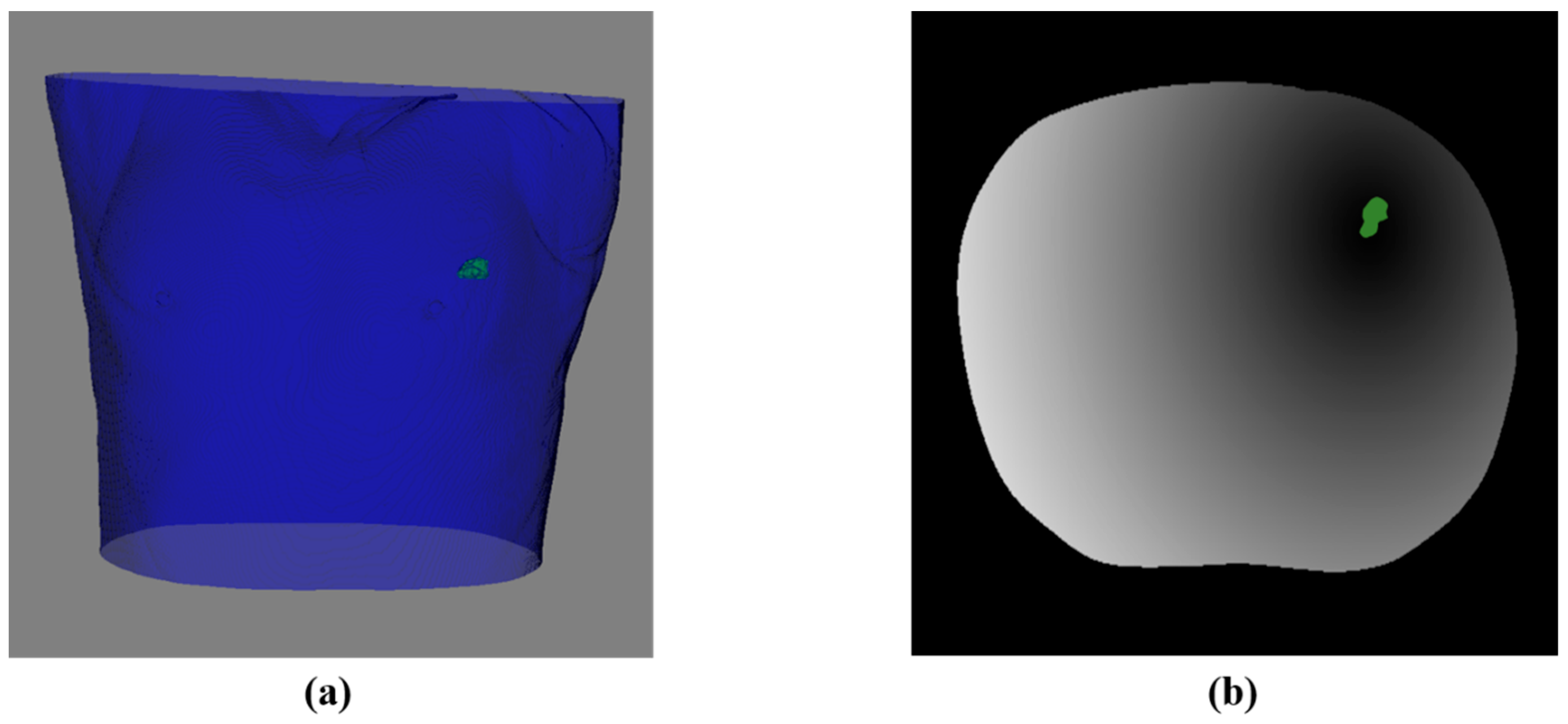 Diagnostics 14 00215 g008