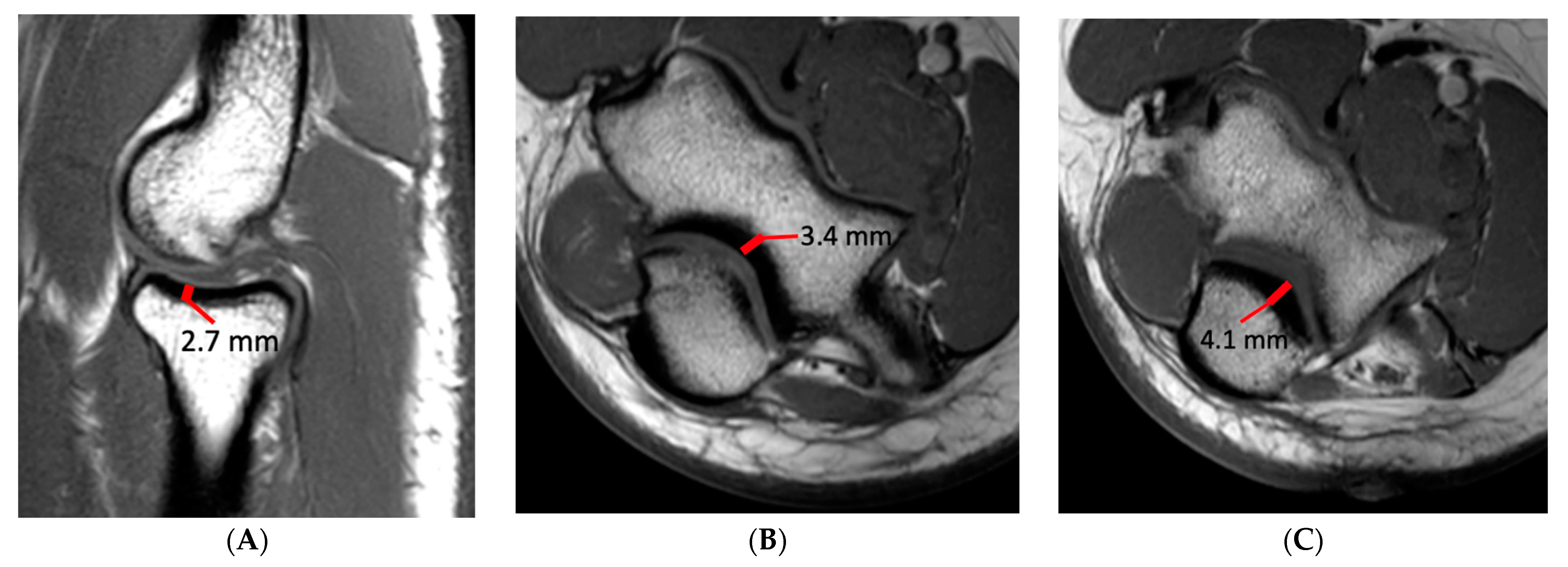 Diagnostics 14 00217 g002