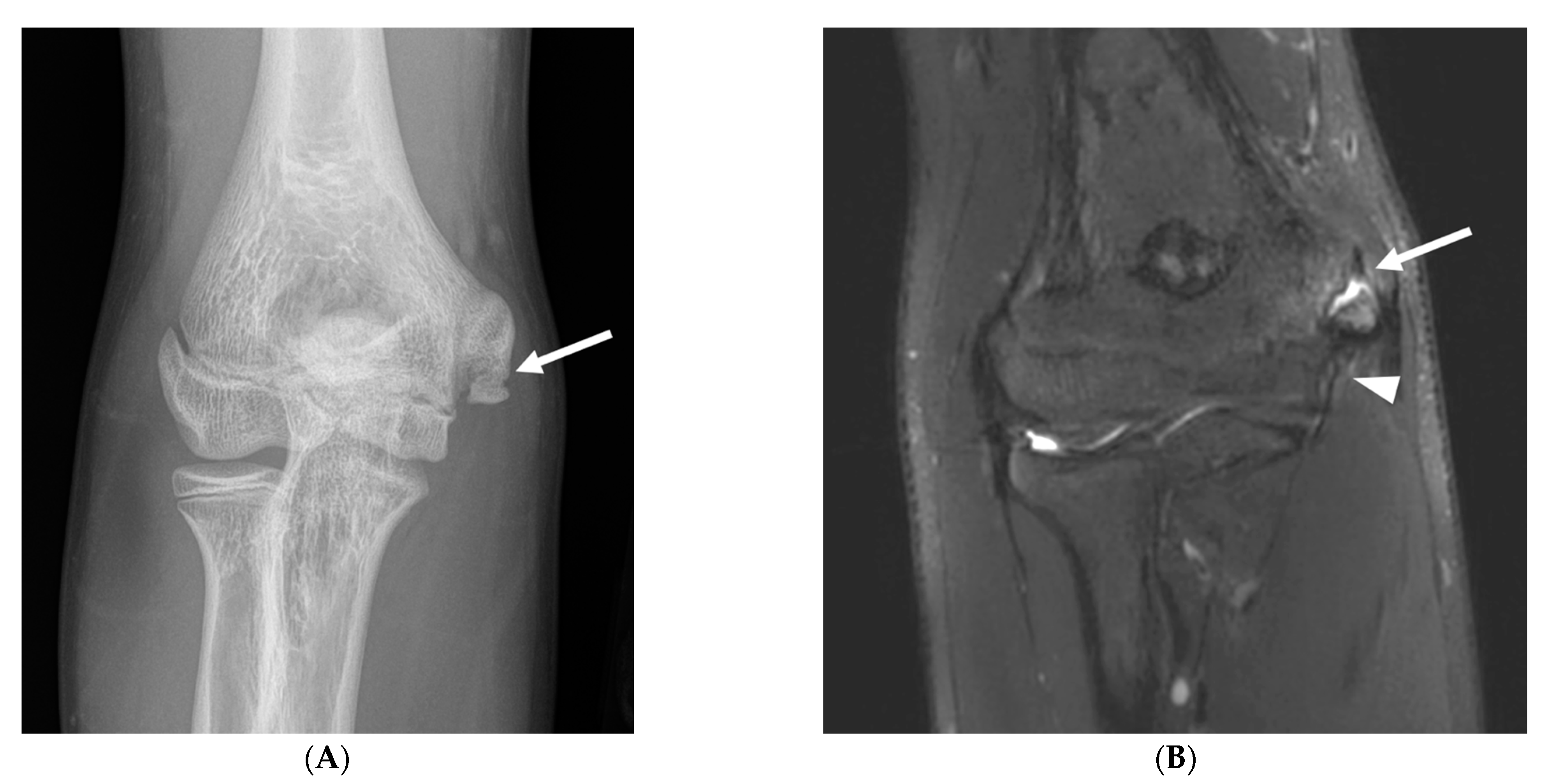 Diagnostics 14 00217 g003