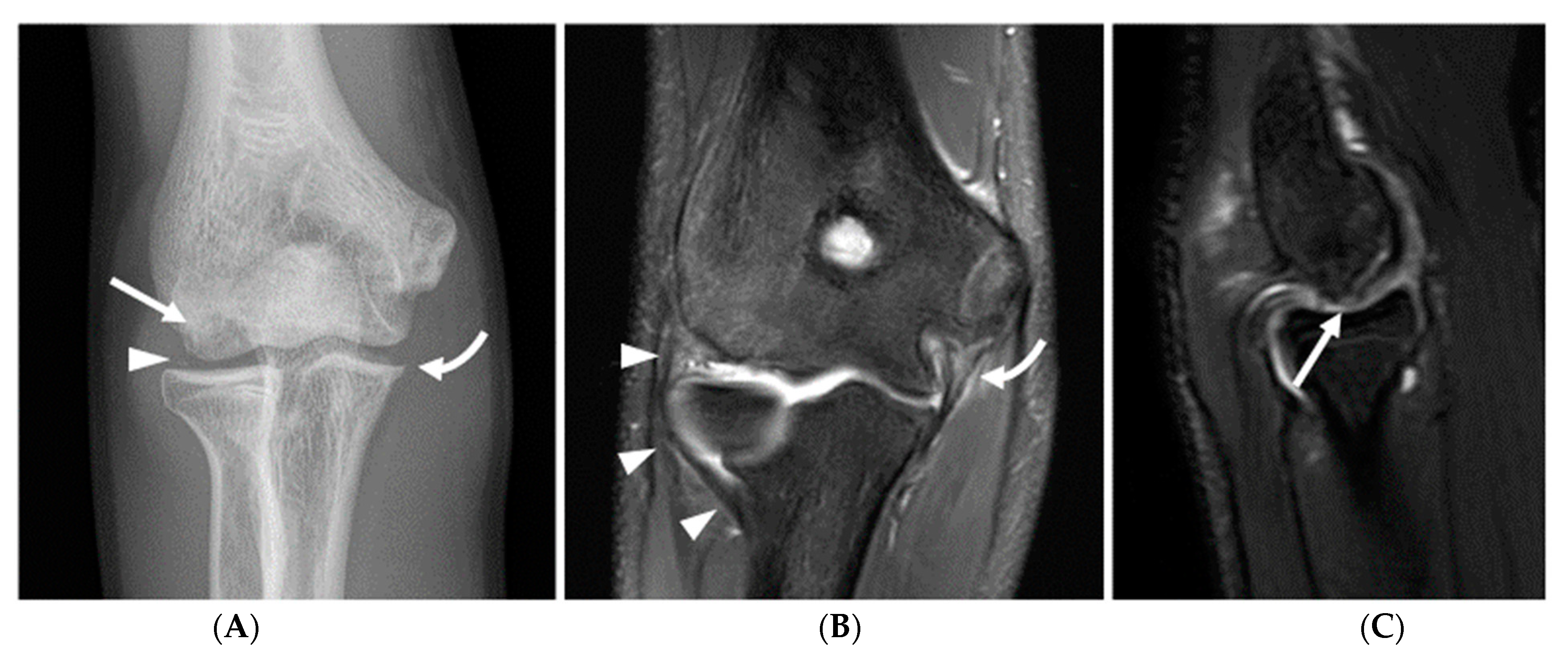 Diagnostics 14 00217 g004