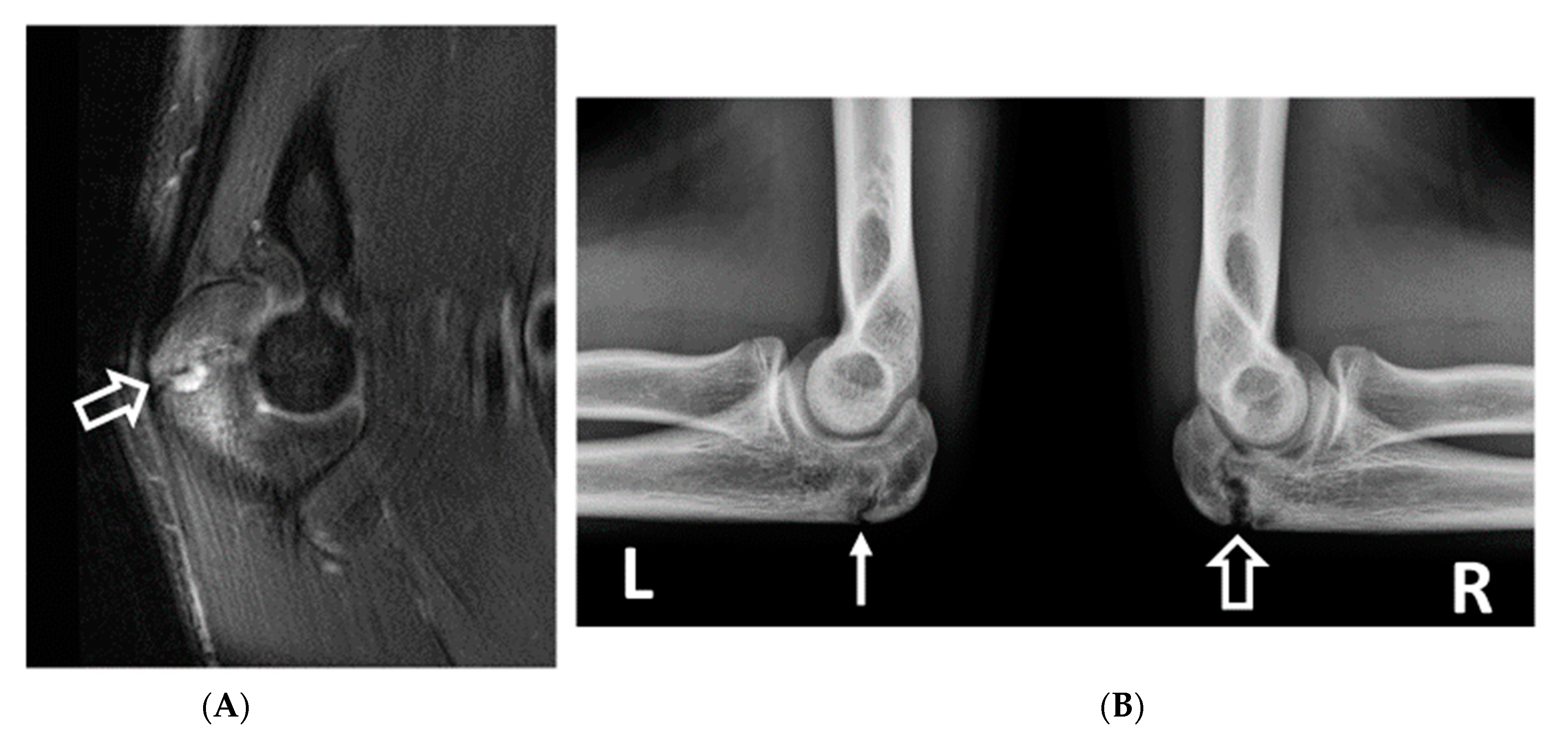 Diagnostics 14 00217 g005
