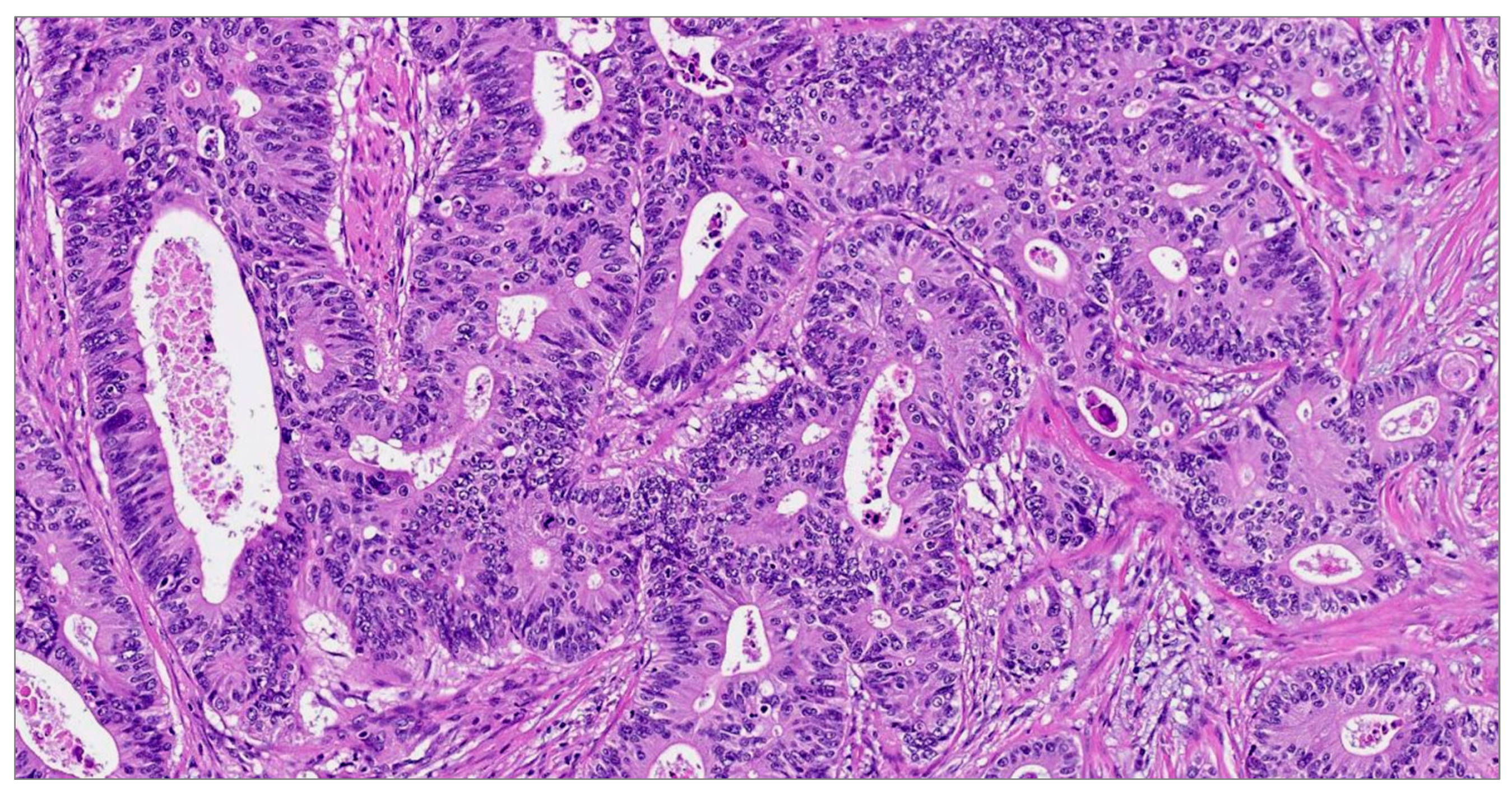 Diagnostics 14 00220 g001