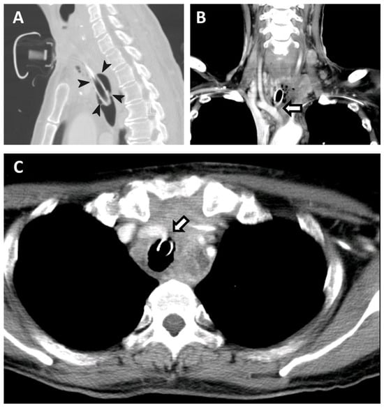 Diagnostics 14 00223 g001