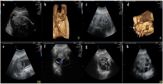 Diagnostics 14 00246 g002