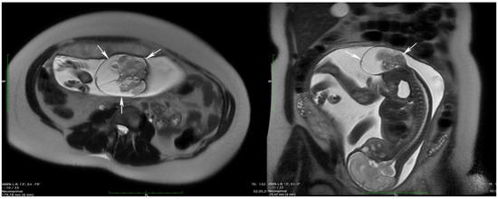 Diagnostics 14 00246 g003