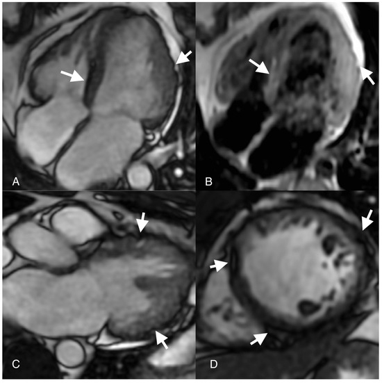 Diagnostics 14 00248 g002