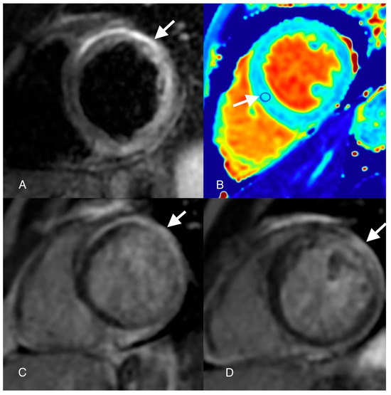 Diagnostics 14 00248 g003