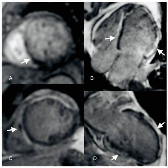 Diagnostics 14 00248 g004