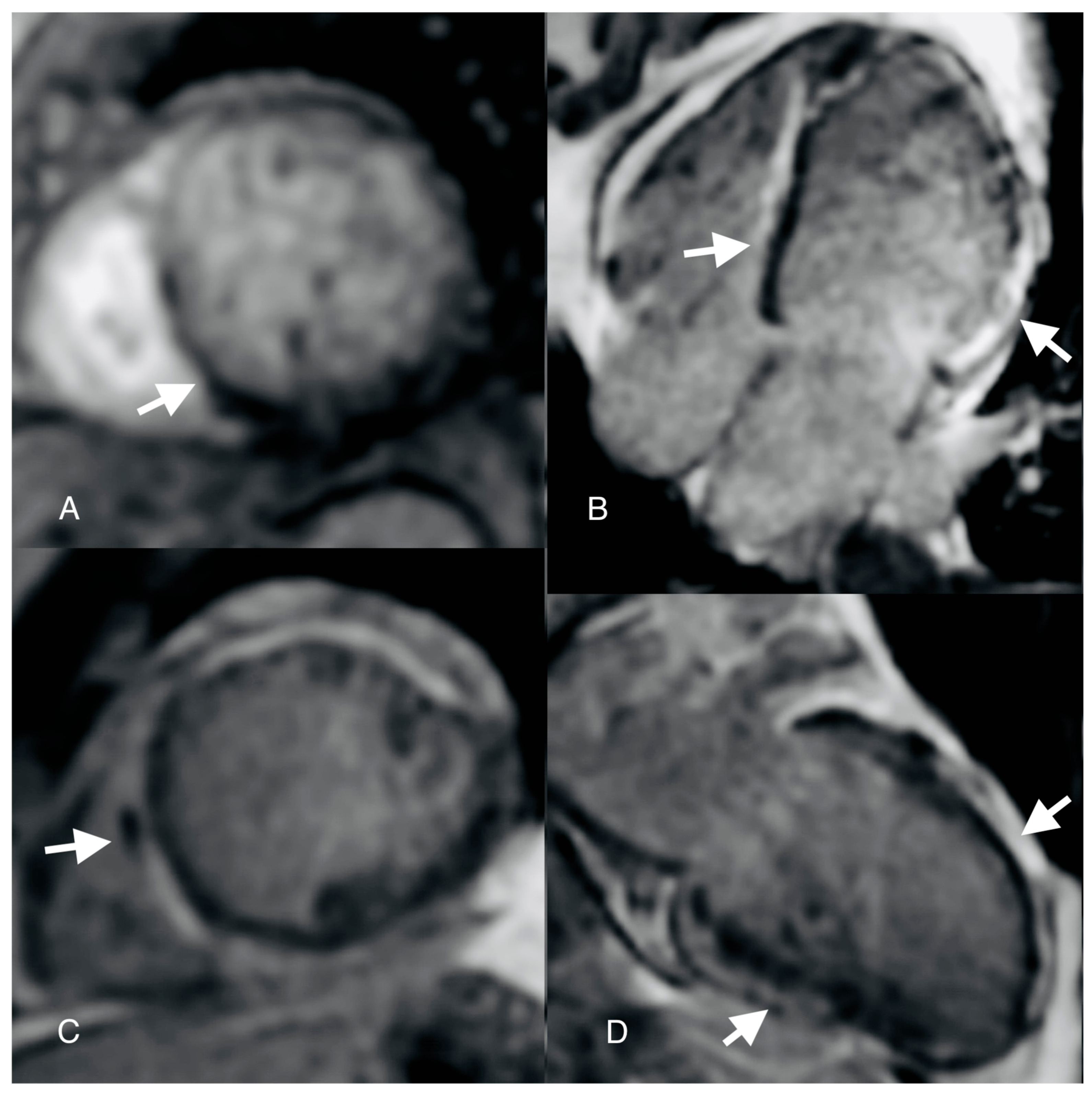 Diagnostics 14 00248 g004