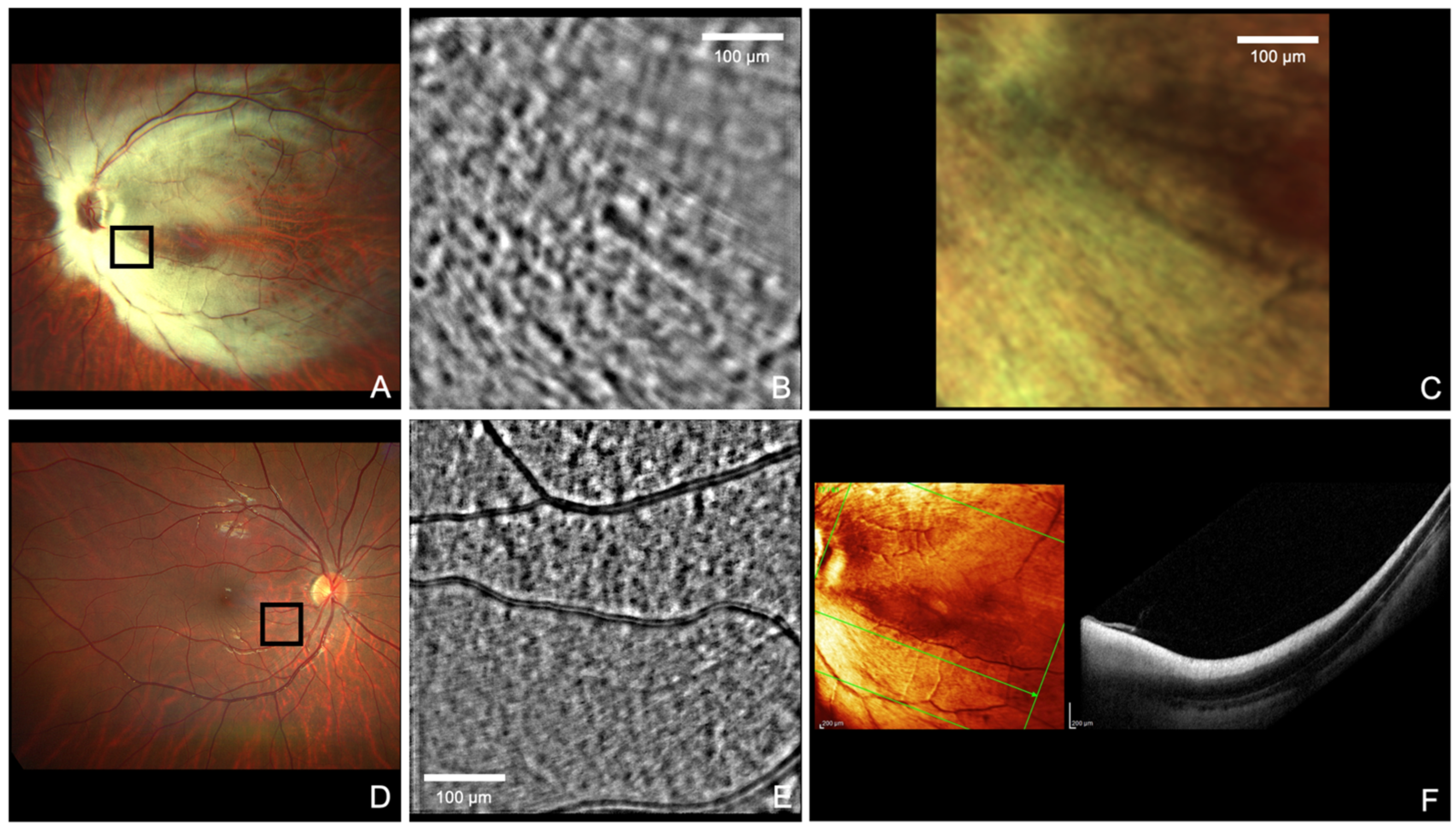 Diagnostics 14 00253 g001