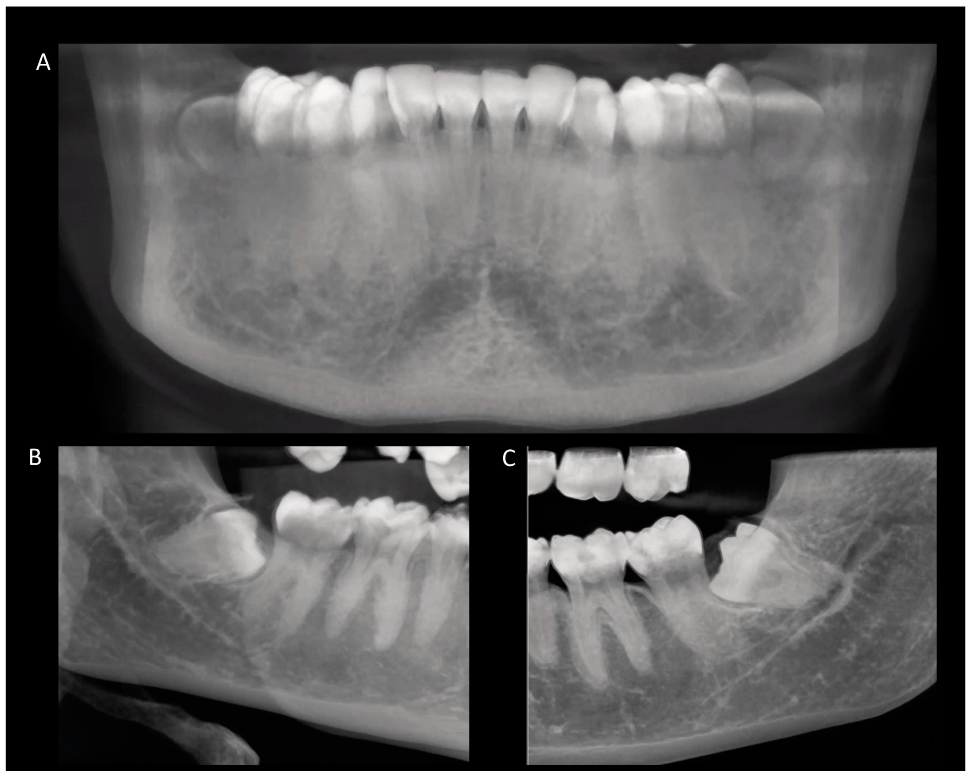 Diagnostics 14 00260 g001