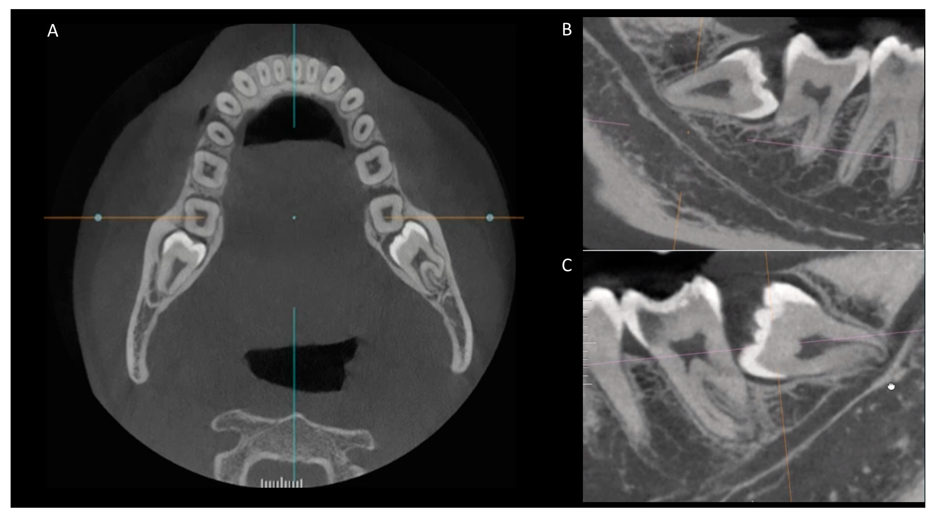 Diagnostics 14 00260 g002