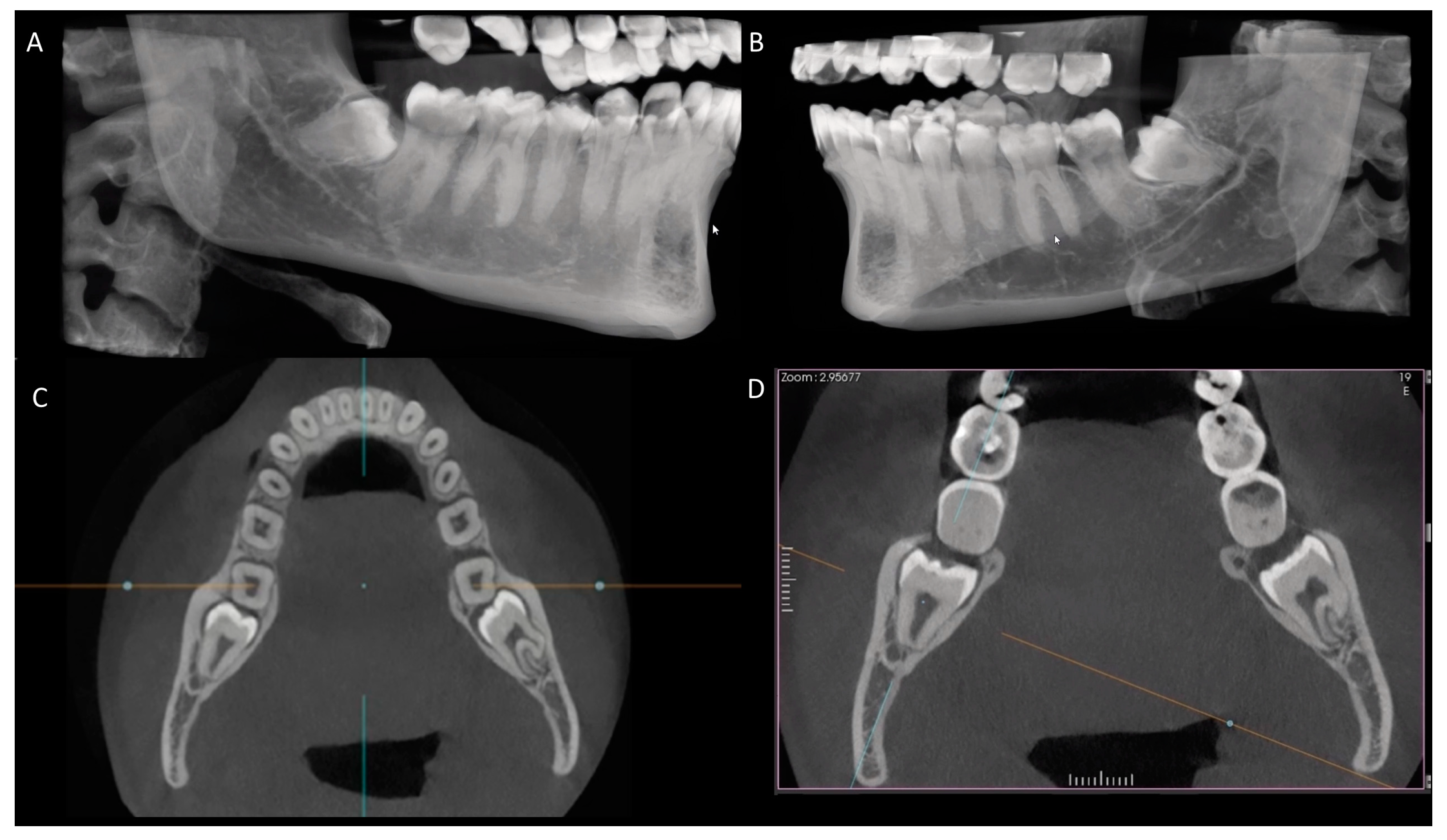 Diagnostics 14 00260 g003