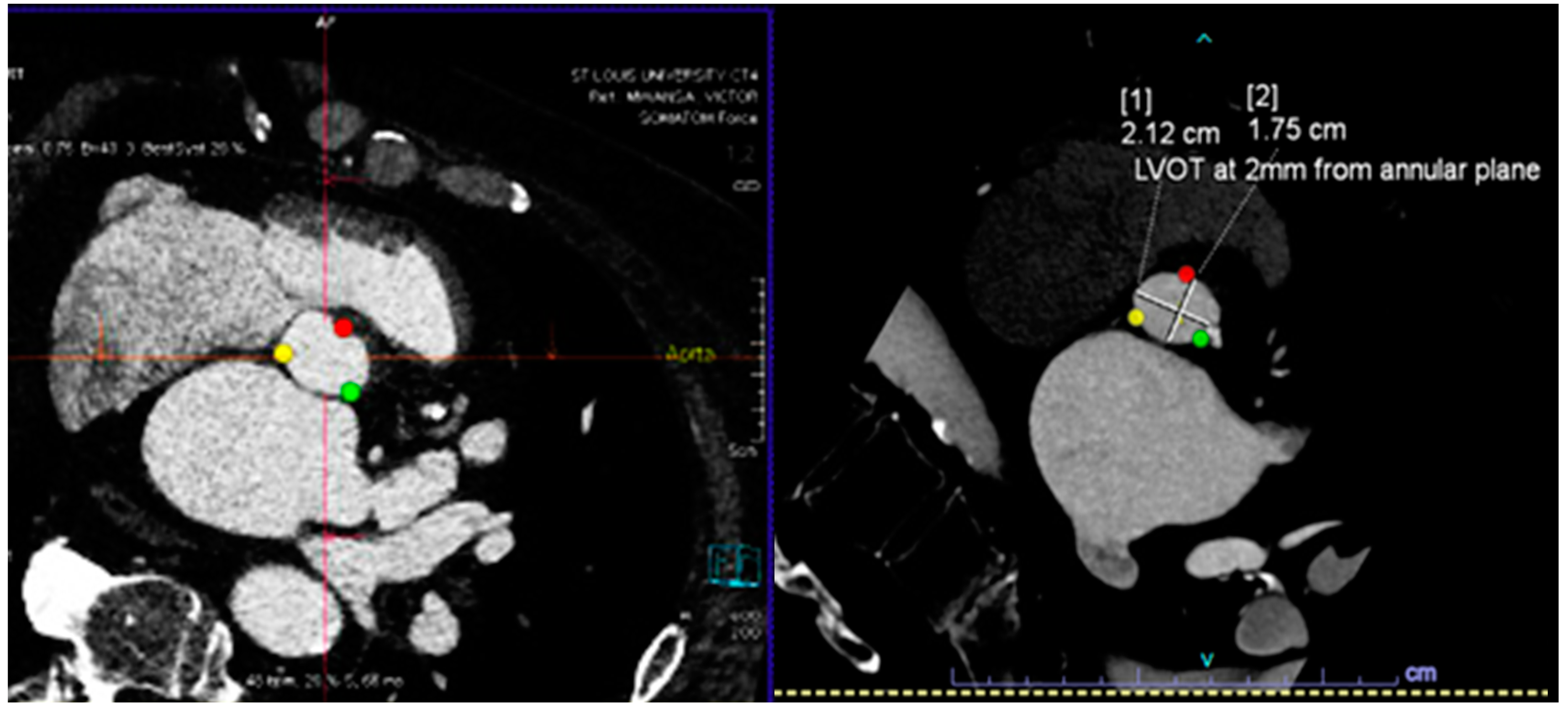 Diagnostics 14 00261 g001a Diagnostics 14 00261 g001a