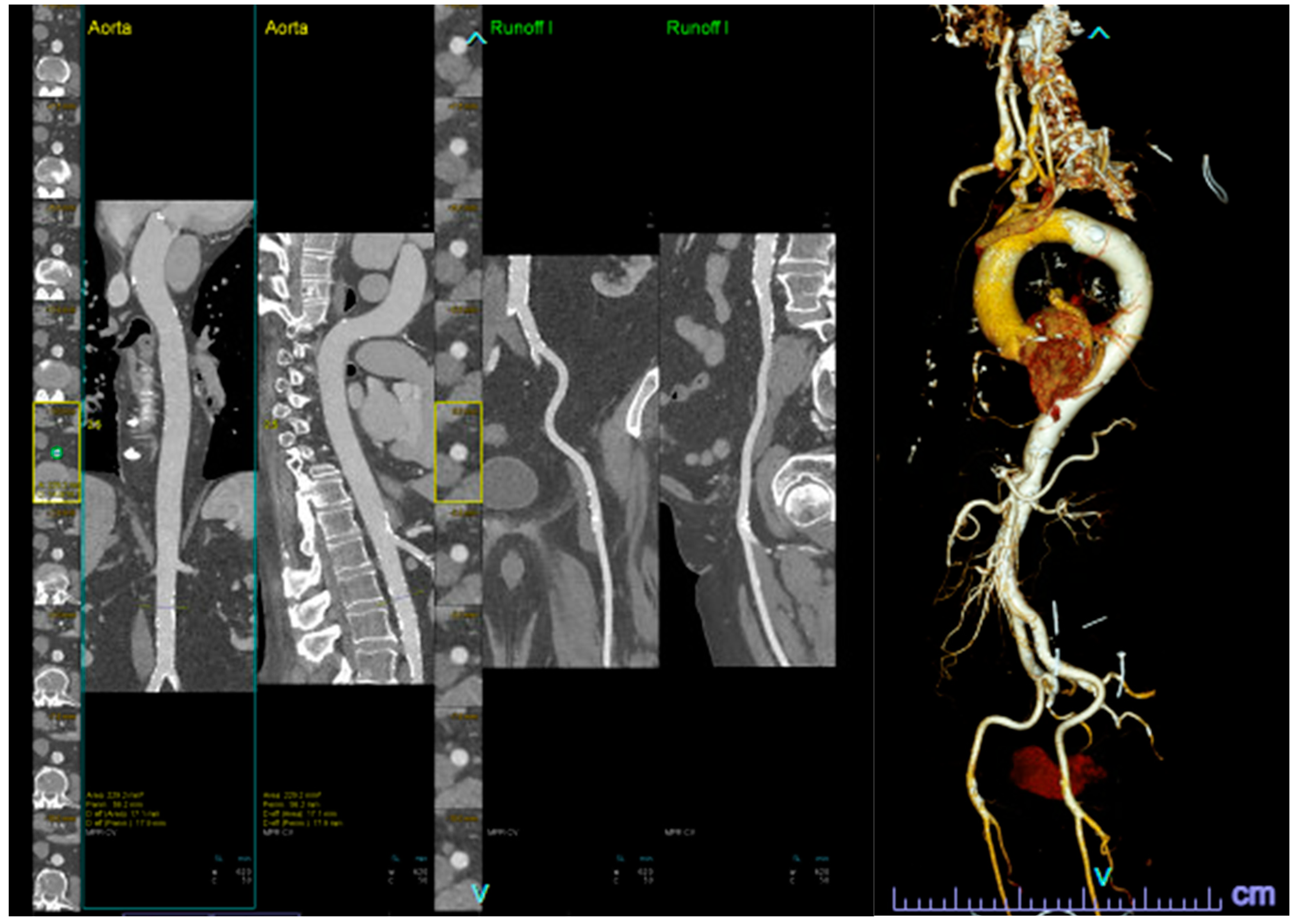 Diagnostics 14 00261 g002 Diagnostics 14 00261 g002