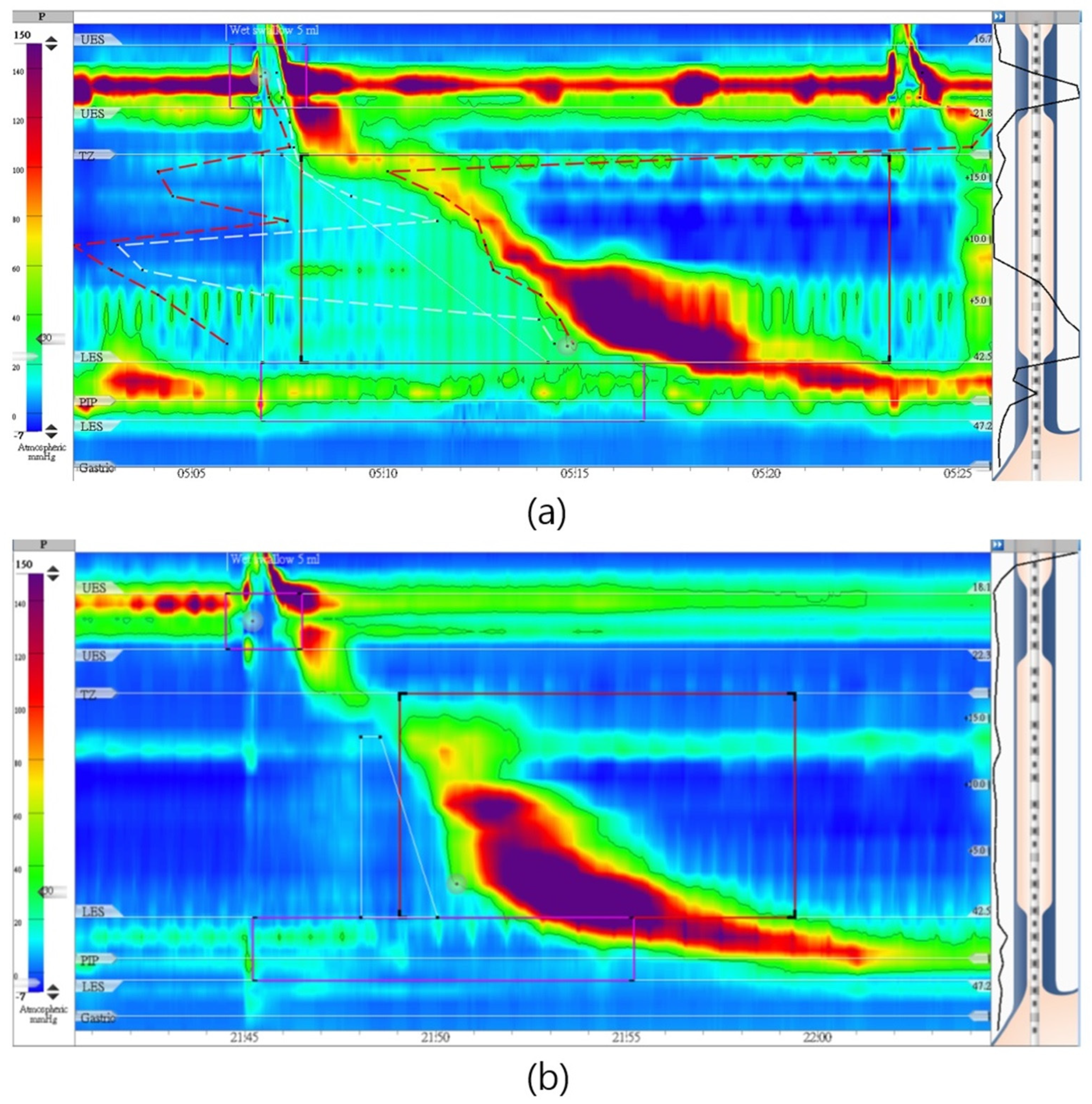 Diagnostics 14 00263 g003