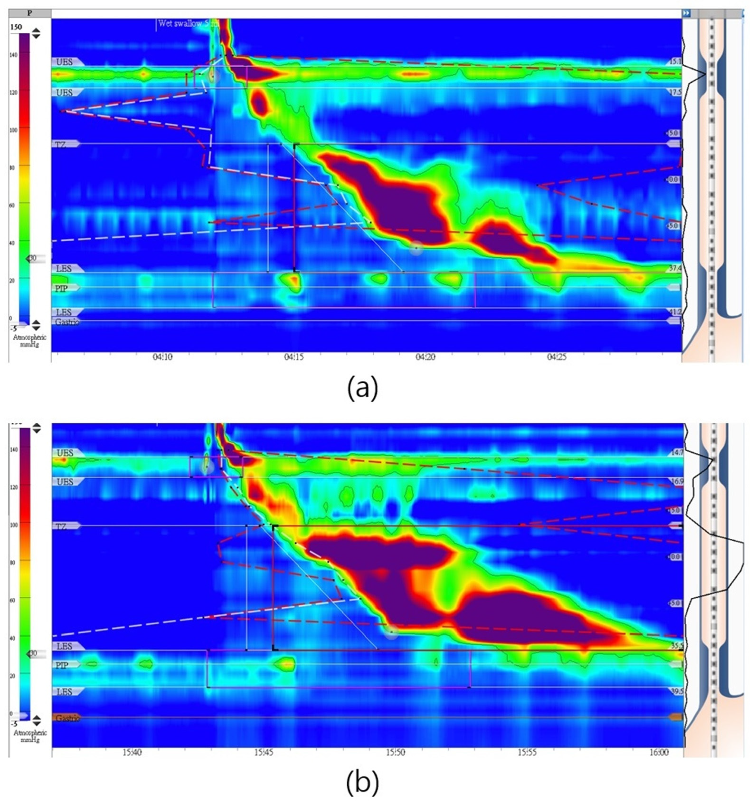 Diagnostics 14 00263 g005