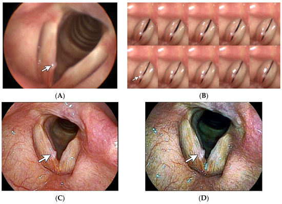 Diagnostics 14 00270 g001