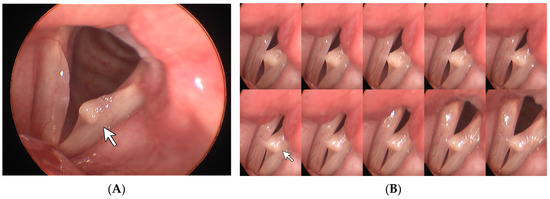 Diagnostics 14 00270 g002a