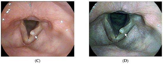 Diagnostics 14 00270 g002b