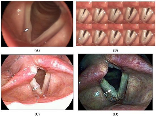 Diagnostics 14 00270 g003