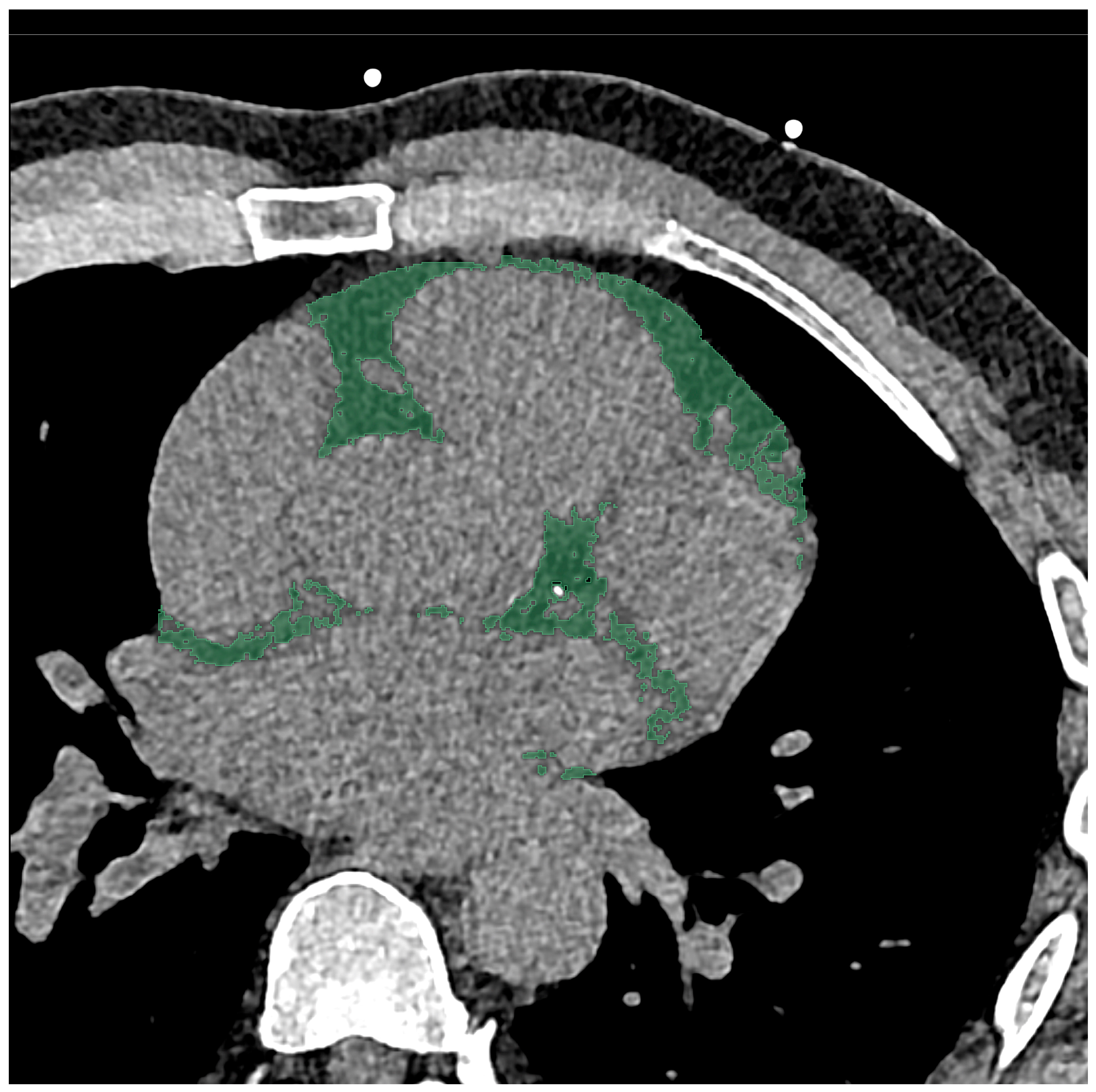 Diagnostics 14 00277 g001 Diagnostics 14 00277 g001