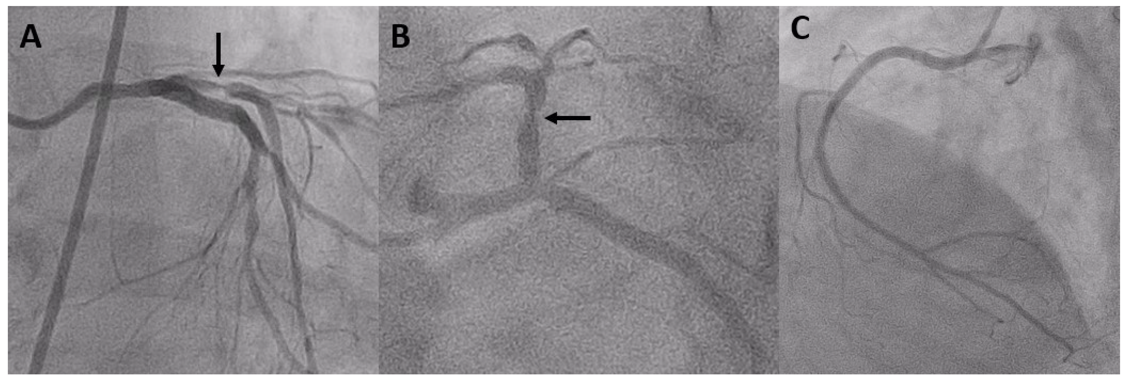 Diagnostics 14 00281 g001