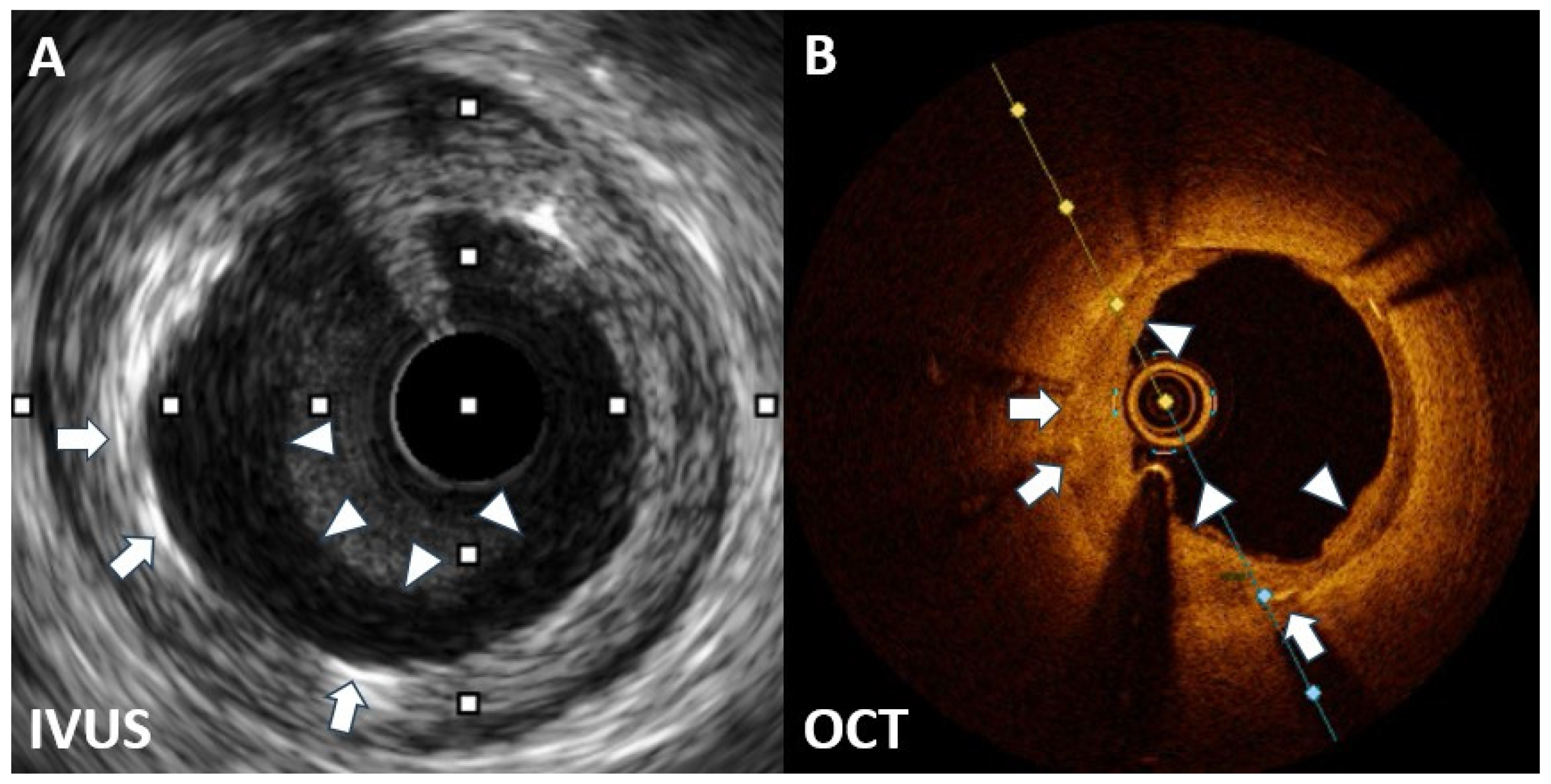 Diagnostics 14 00281 g002