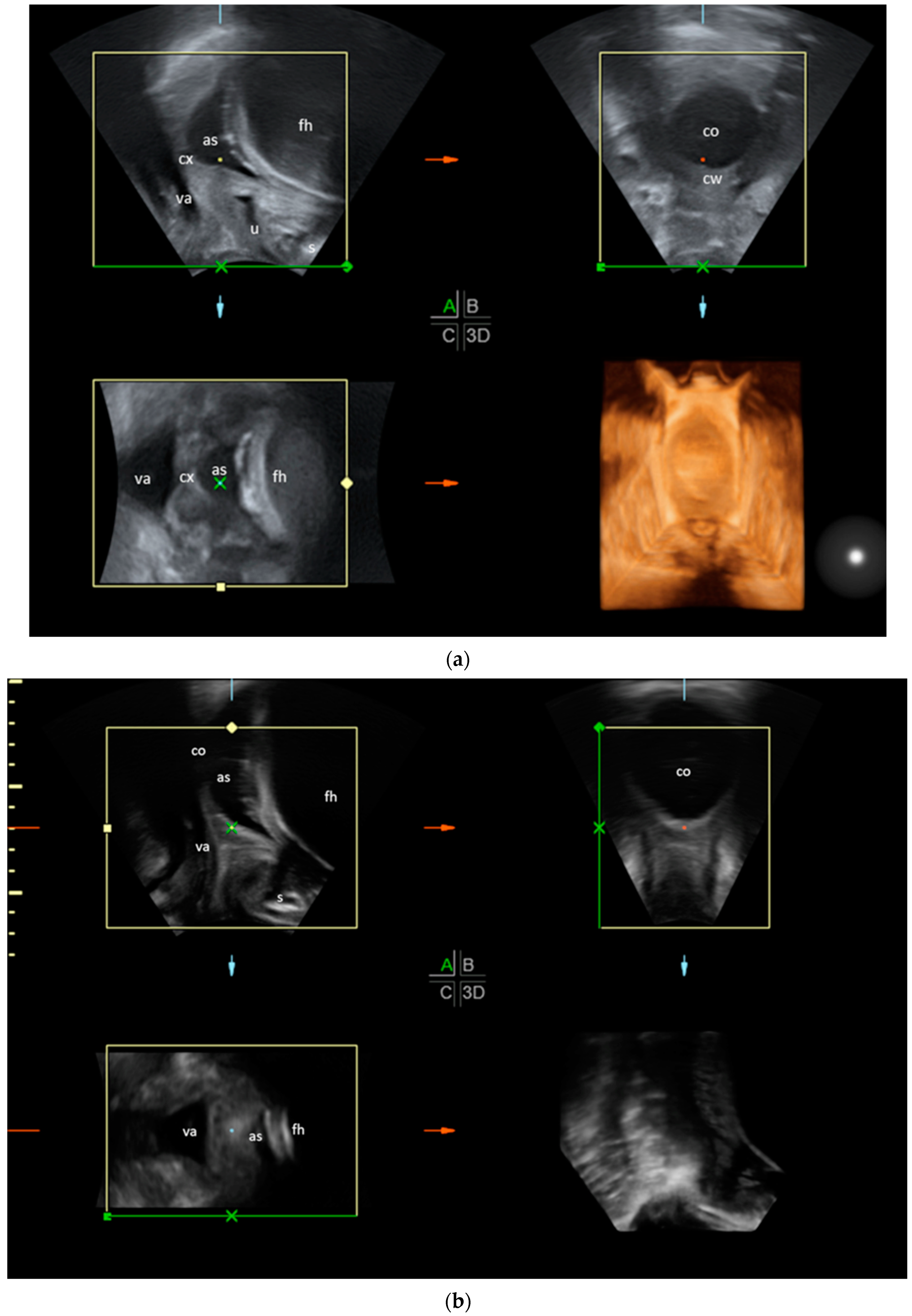 Diagnostics 14 00293 g001