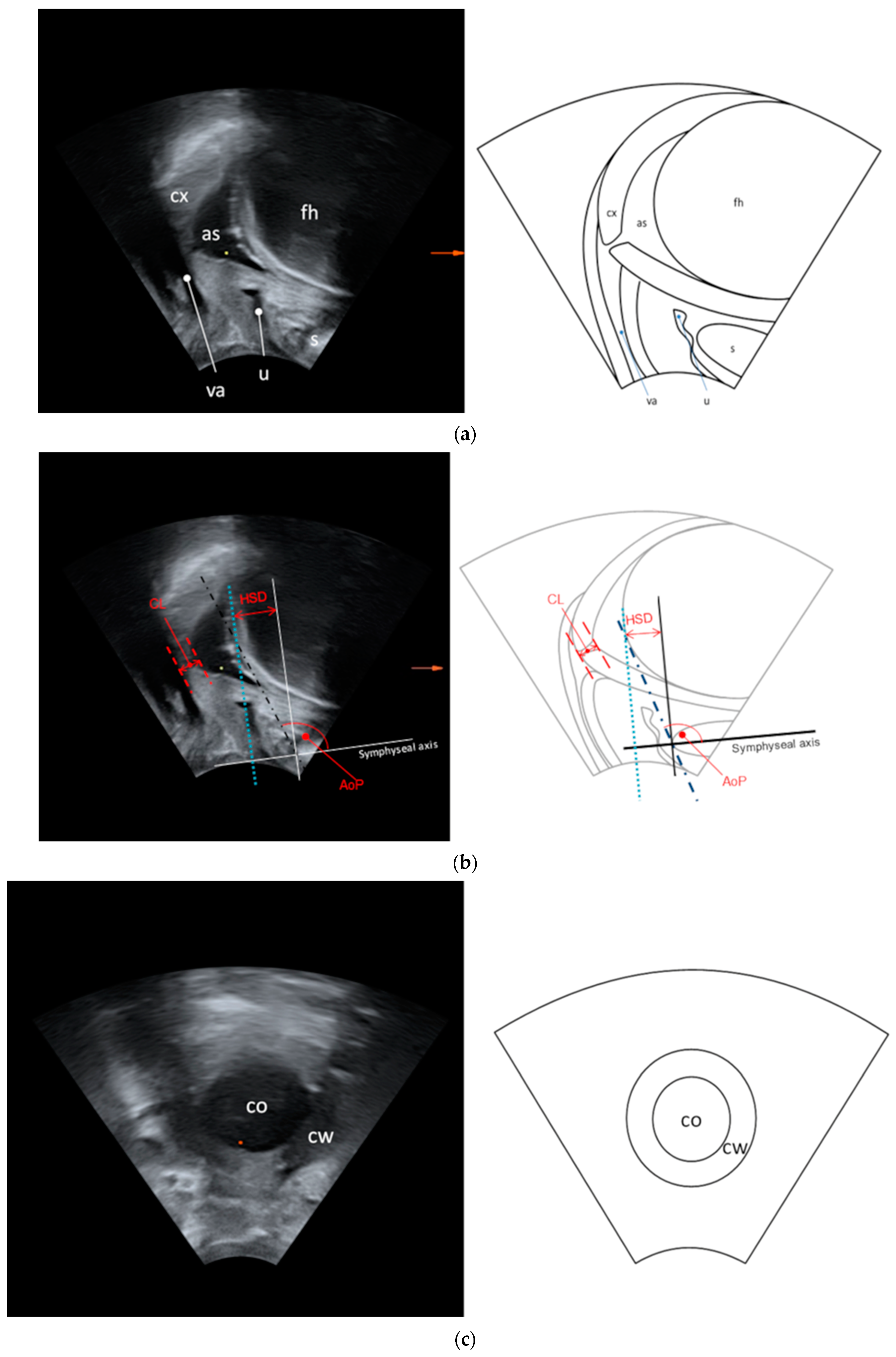 Diagnostics 14 00293 g002a