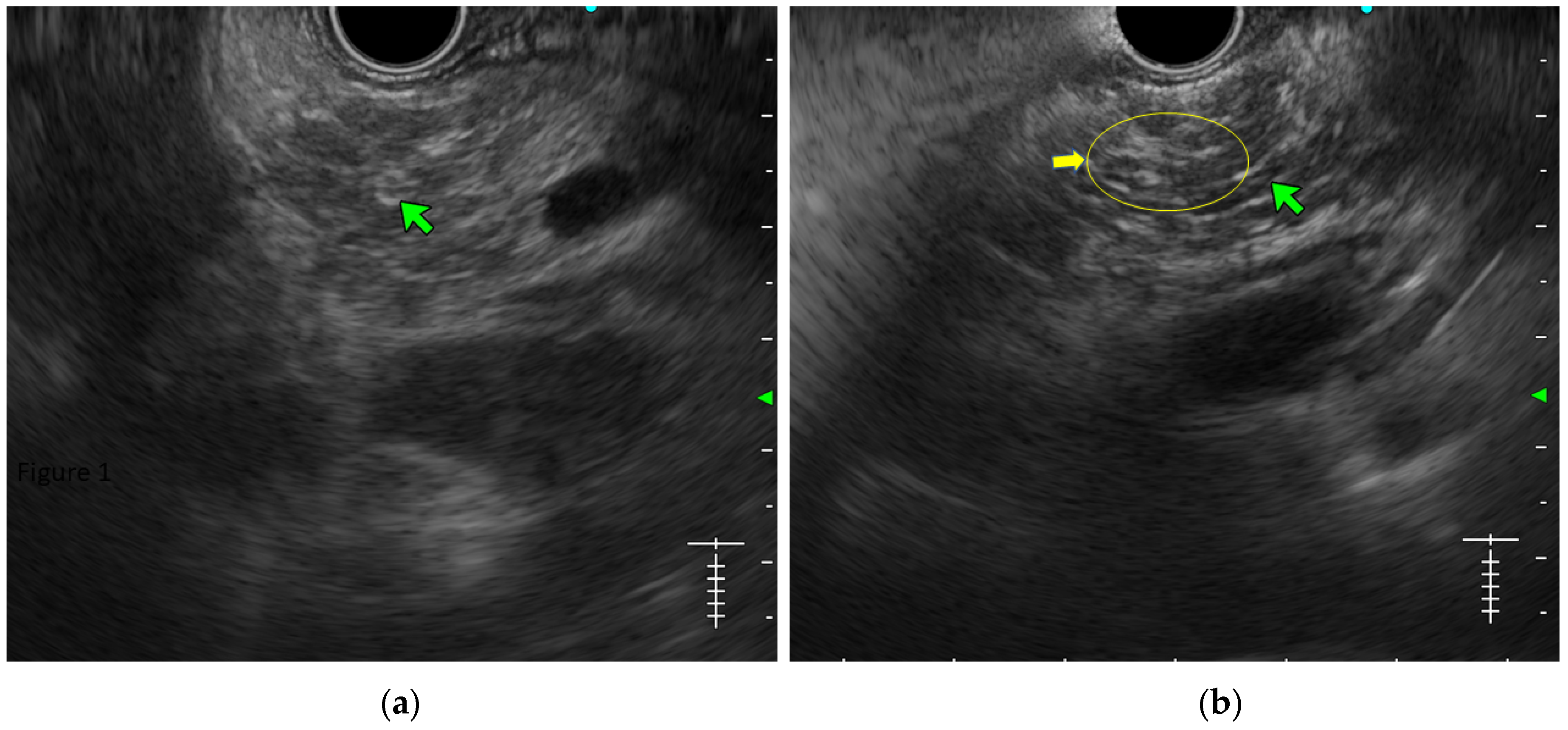 Diagnostics 14 00298 g002