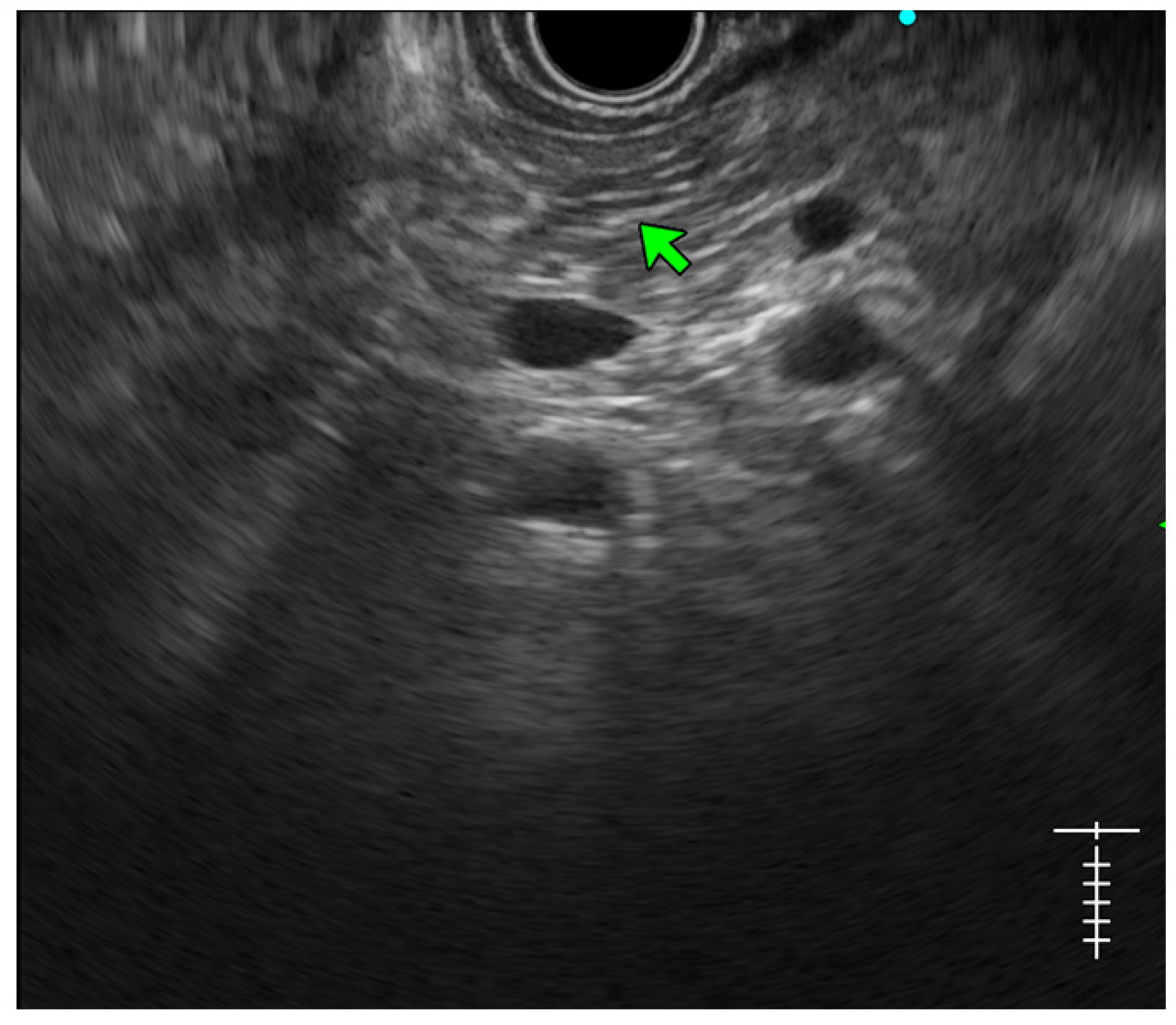 Diagnostics 14 00298 g004