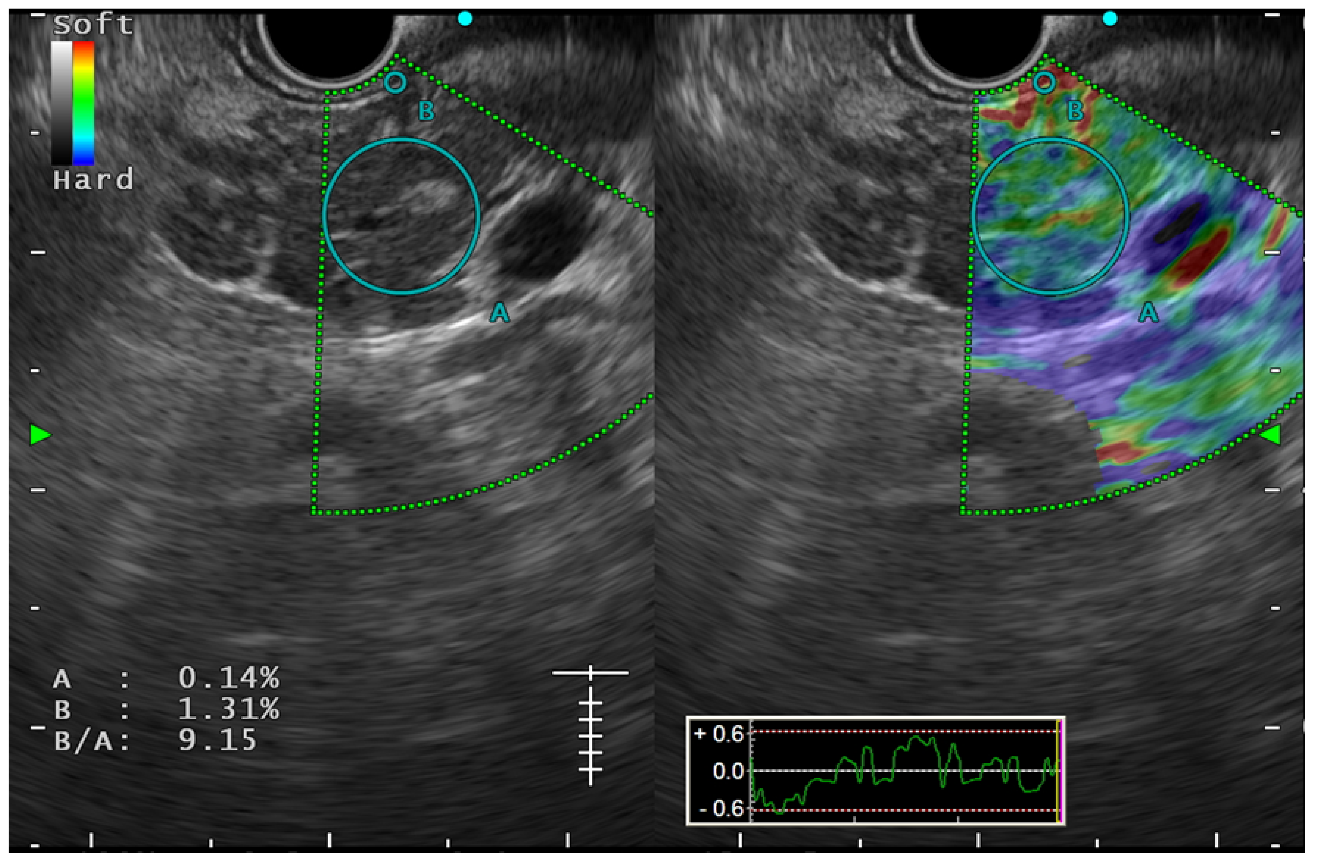 Diagnostics 14 00298 g005
