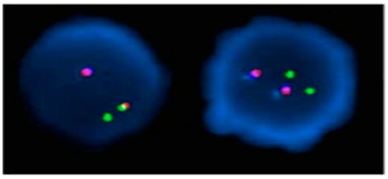 Diagnostics 14 00303 g002