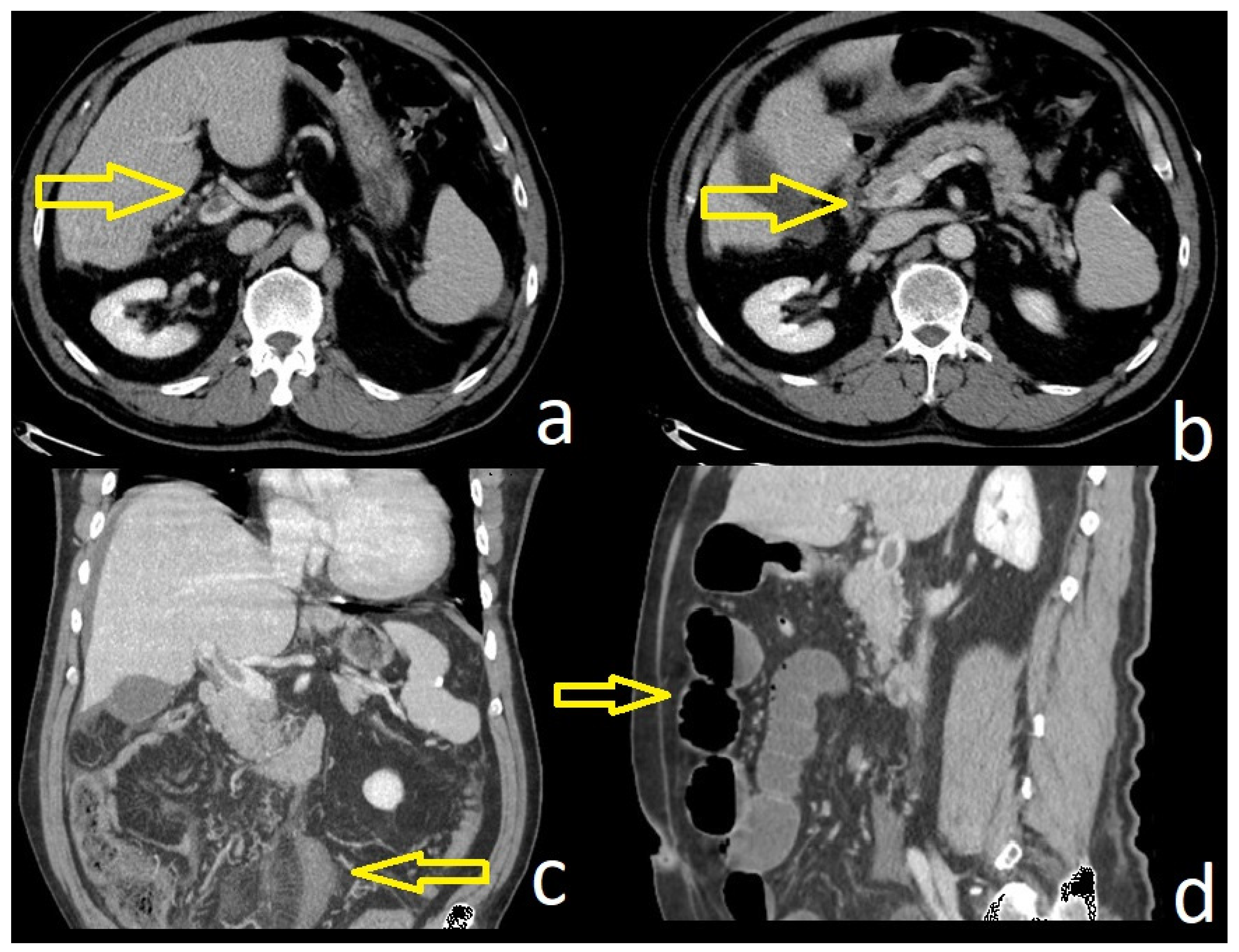 Diagnostics 14 00304 g001
