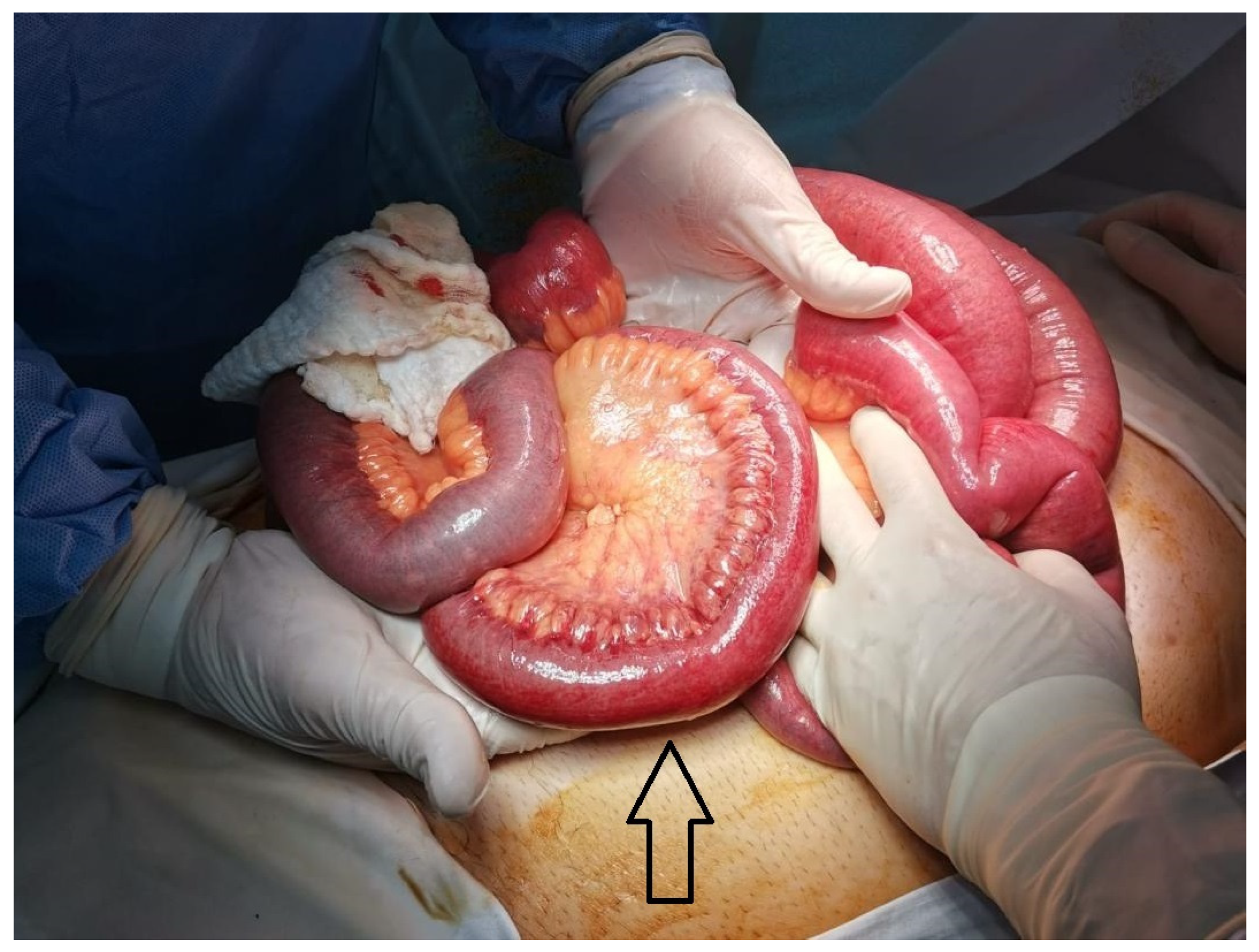 Diagnostics 14 00304 g002