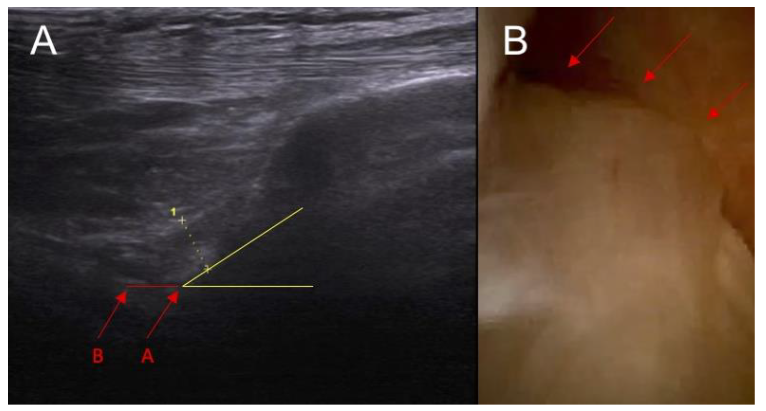 Diagnostics 14 00305 g001