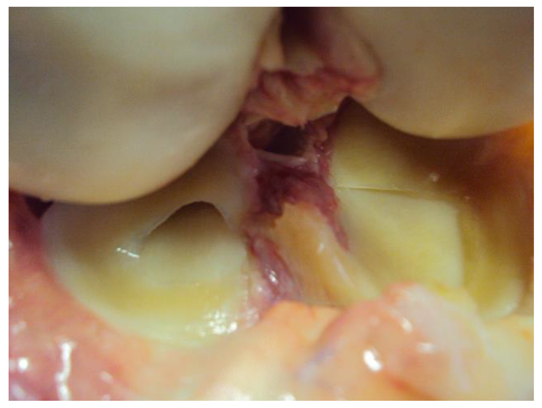 Diagnostics 14 00305 g002