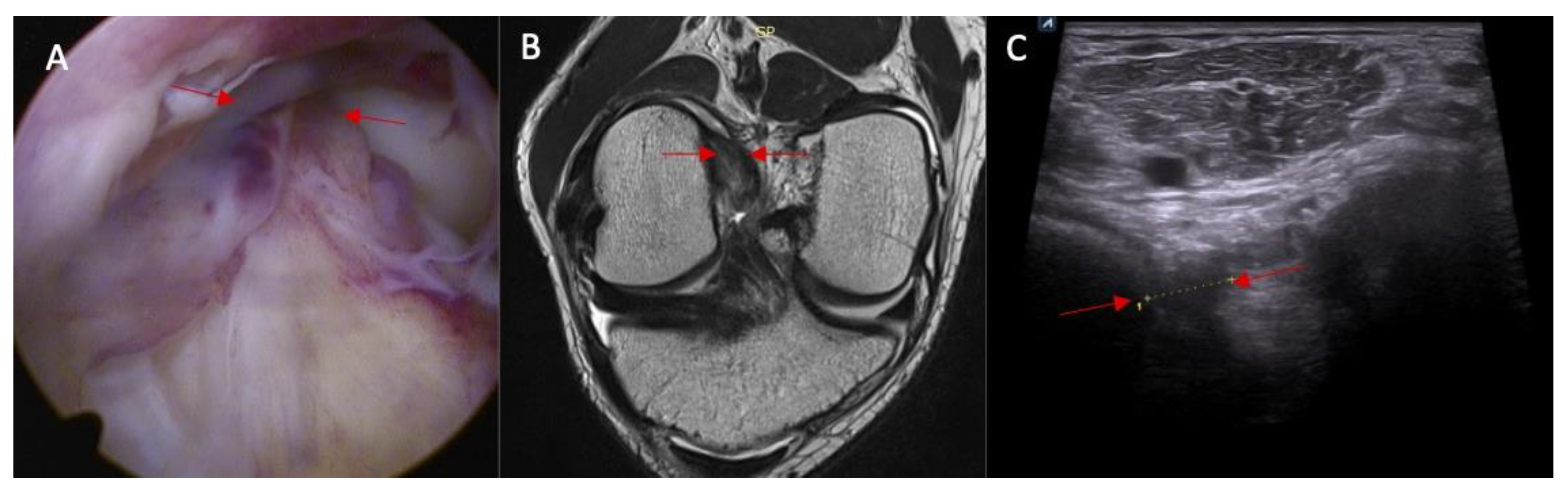 Diagnostics 14 00305 g005